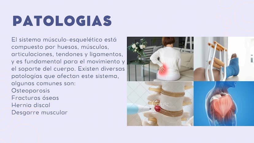 INTRODUCCIÓN
En el sistema
sistema muscular y el esquelético
trabajan juntos para dar sostén y mover
el cuerpo.
musculoesquelético, el
Los h