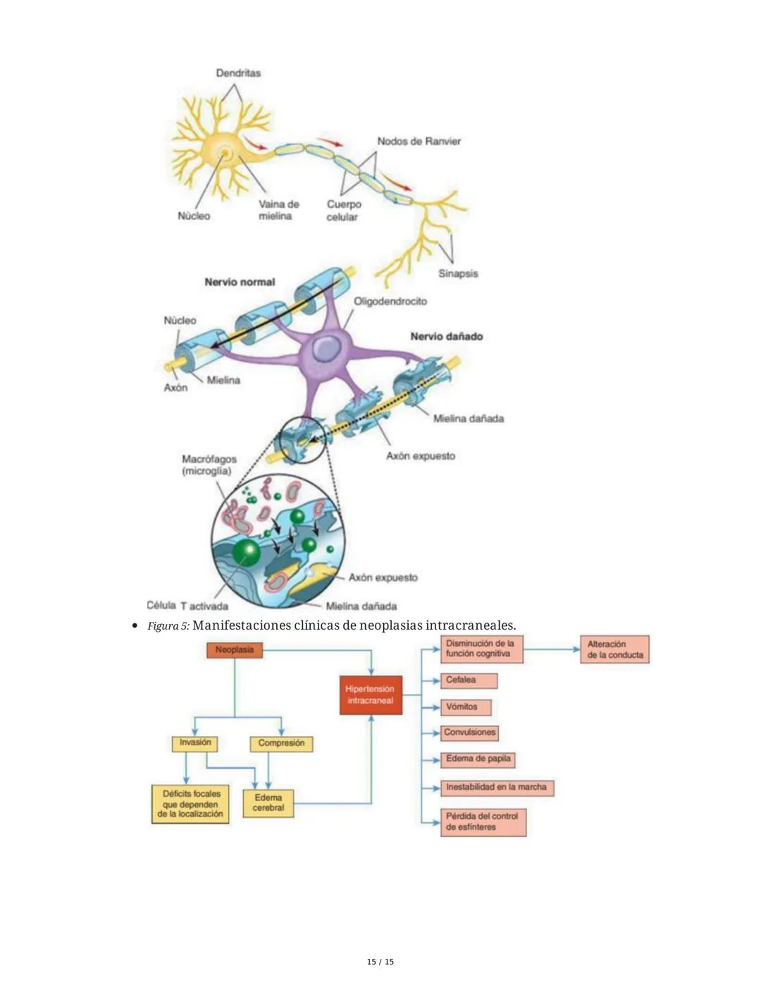 CAPÍTULO 18: Trastornos Transitorios del SNC, SNP y de la
Unión Neuromuscular
1. Trastornos del Sistema Nervioso Central
1.1 Traumatismo Enc