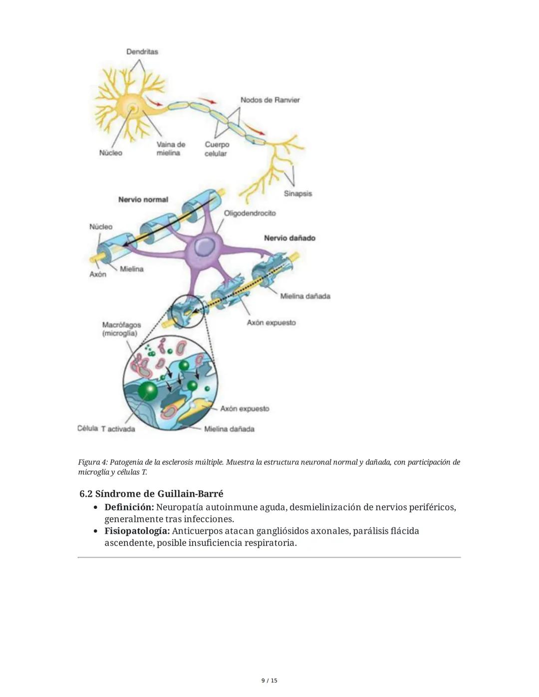 CAPÍTULO 18: Trastornos Transitorios del SNC, SNP y de la
Unión Neuromuscular
1. Trastornos del Sistema Nervioso Central
1.1 Traumatismo Enc
