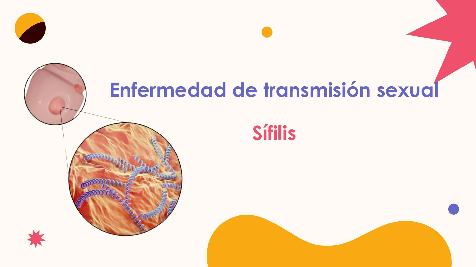 # Enfermedad de transmisión sexual
Sifilis INTEGRANTES
Sarmiento Mendoza josué
Flores Arenas Victor Manuel
Castro Martínez Renato
Domingue