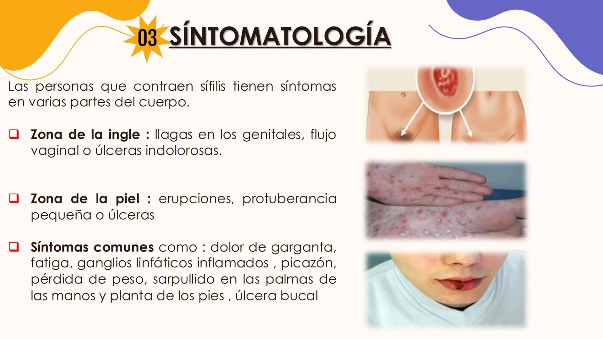 # Enfermedad de transmisión sexual
Sifilis INTEGRANTES
Sarmiento Mendoza josué
Flores Arenas Victor Manuel
Castro Martínez Renato
Domingue