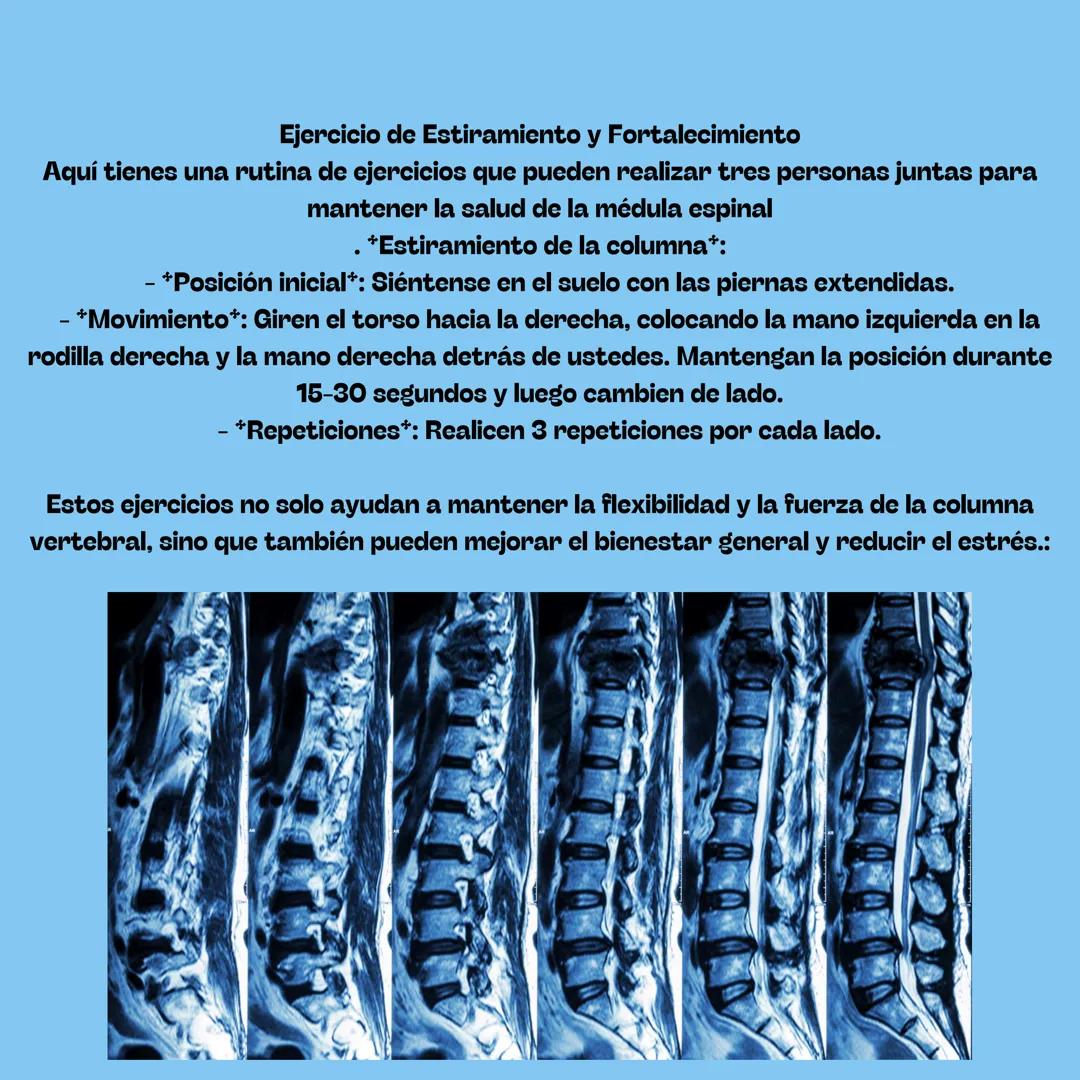 # MEDULA
ESPINAL
QUE ES
LA
MEDULA
ESPINAL
, una estructura vital del sistema nervioso central, es un
cordón largo y delgado que se extiend