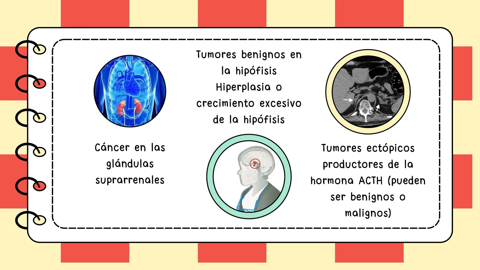 # Síndrome de cushing # CONTENIDO
Definición
Epidemiologia
Diagnostico
Signos y síntomas
Causas y trtamiento
Caso clínico
01
02
03