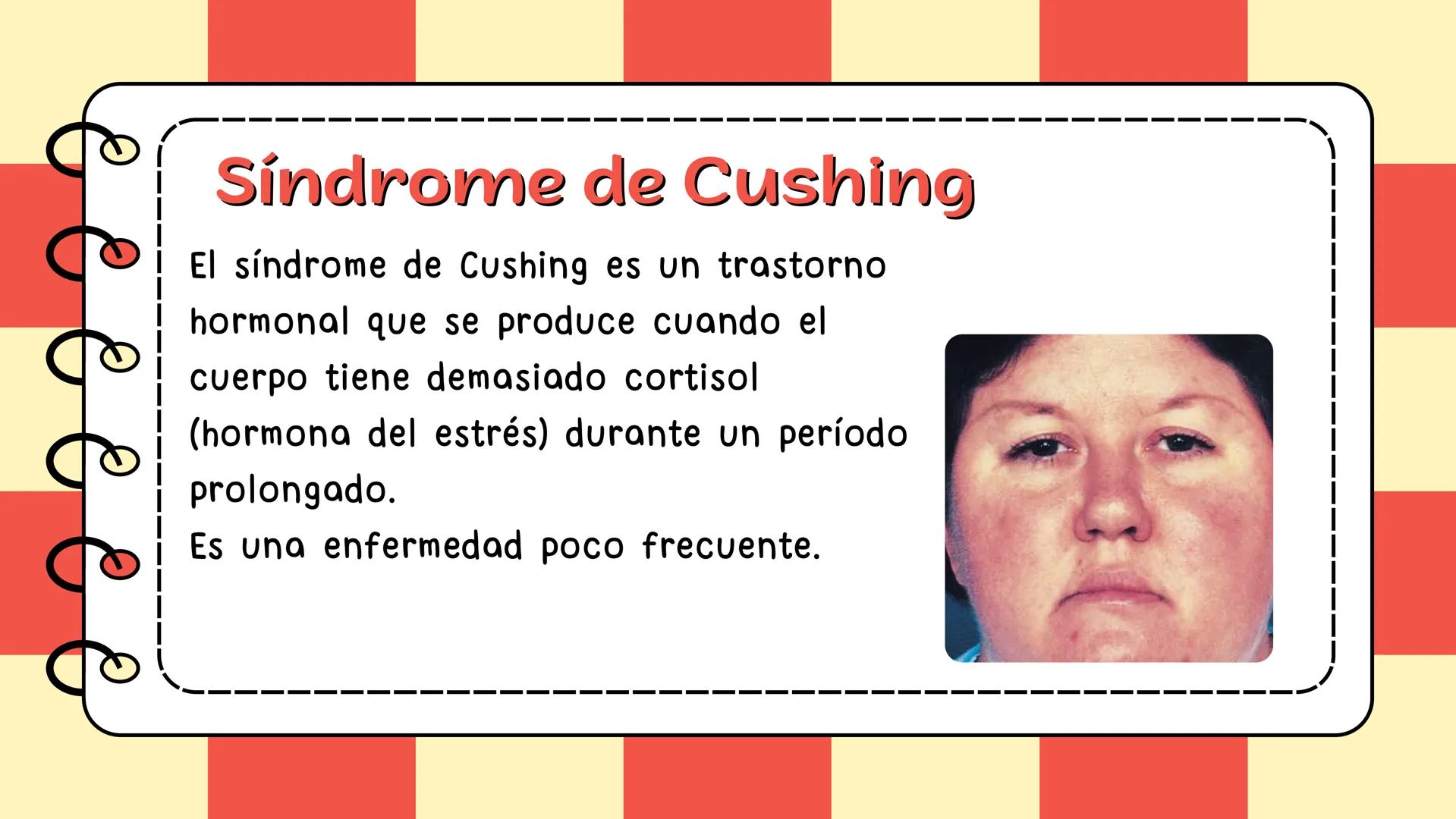 # Síndrome de cushing # CONTENIDO
Definición
Epidemiologia
Diagnostico
Signos y síntomas
Causas y trtamiento
Caso clínico
01
02
03