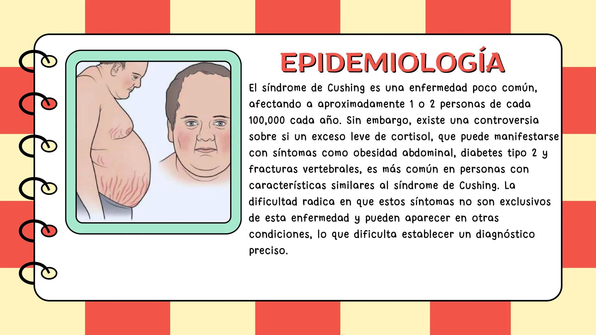 # Síndrome de cushing # CONTENIDO
Definición
Epidemiologia
Diagnostico
Signos y síntomas
Causas y trtamiento
Caso clínico
01
02
03