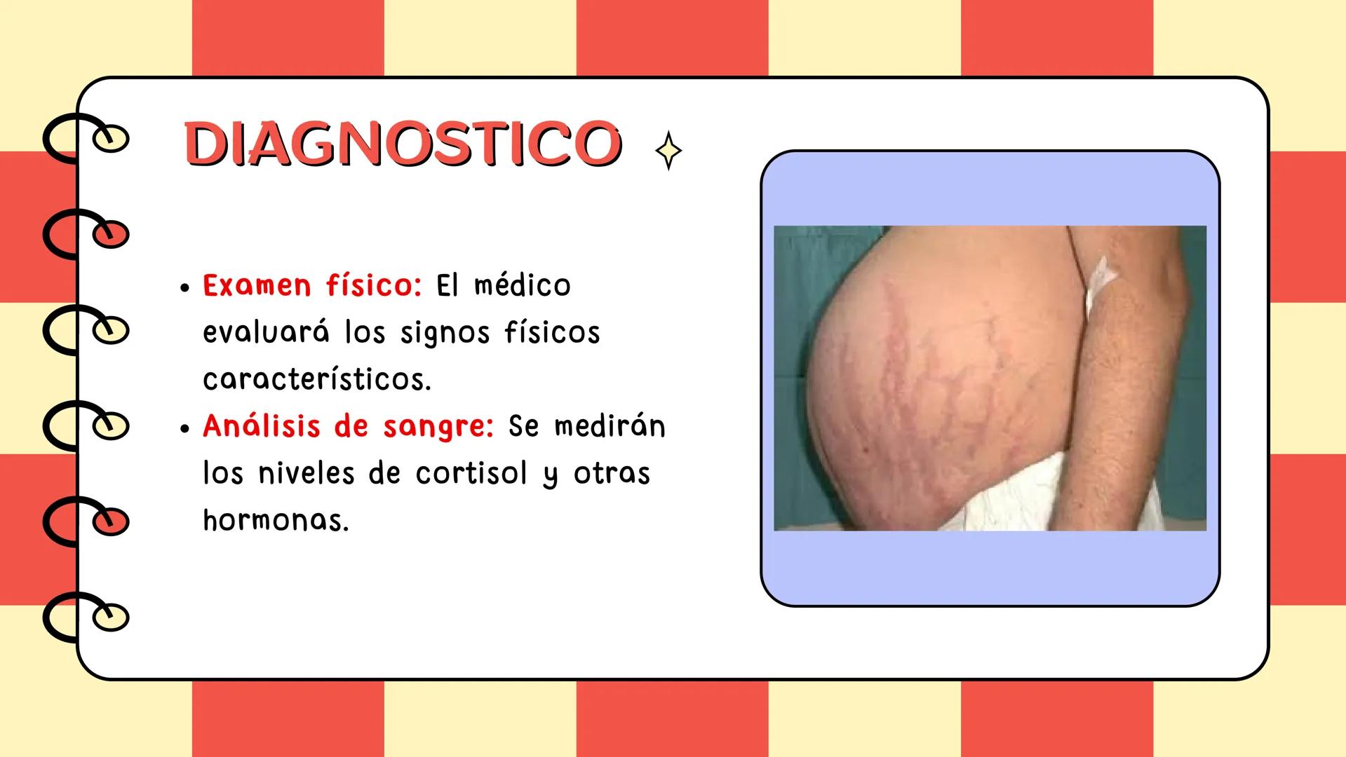 # Síndrome de cushing # CONTENIDO
Definición
Epidemiologia
Diagnostico
Signos y síntomas
Causas y trtamiento
Caso clínico
01
02
03