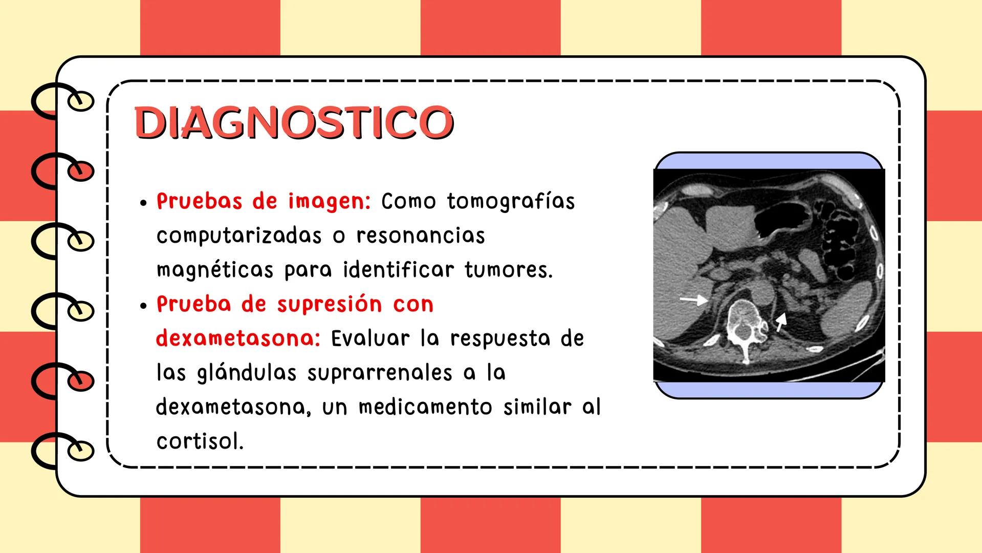 # Síndrome de cushing # CONTENIDO
Definición
Epidemiologia
Diagnostico
Signos y síntomas
Causas y trtamiento
Caso clínico
01
02
03