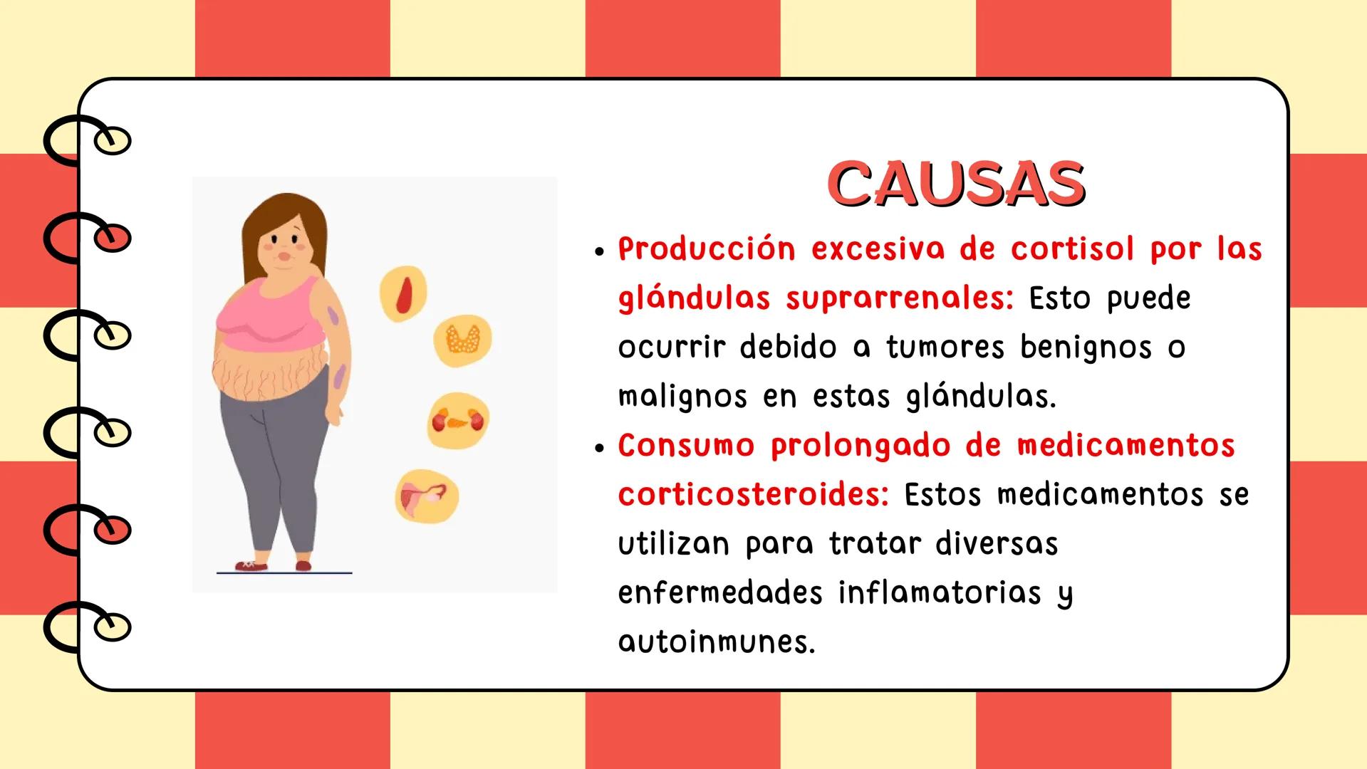 # Síndrome de cushing # CONTENIDO
Definición
Epidemiologia
Diagnostico
Signos y síntomas
Causas y trtamiento
Caso clínico
01
02
03
