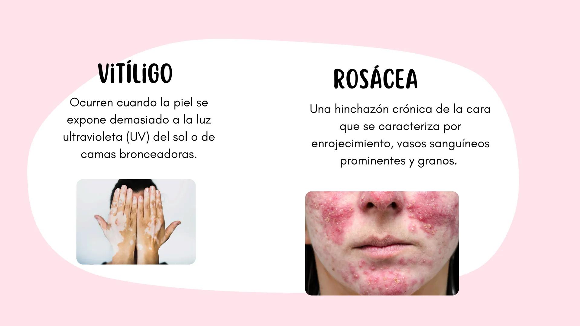 Sistema
TEGUMENTARIO # CIENCIAS DE LA SALUD
!! # ¿QUÉ ES EL SISTEMA TEGUMENTARIO?
El sistema tegumentario está compuesto por la piel,
el c