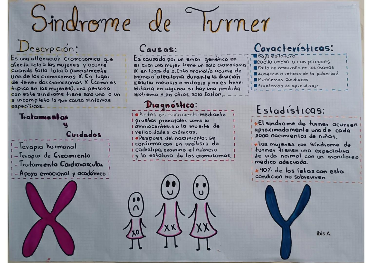 # Sindrome de Turner
Descrcpción:
Es una alteración cromosomica que
afecta solo a las mujeres y ocurre
cuando falta total o parcialmente
Un