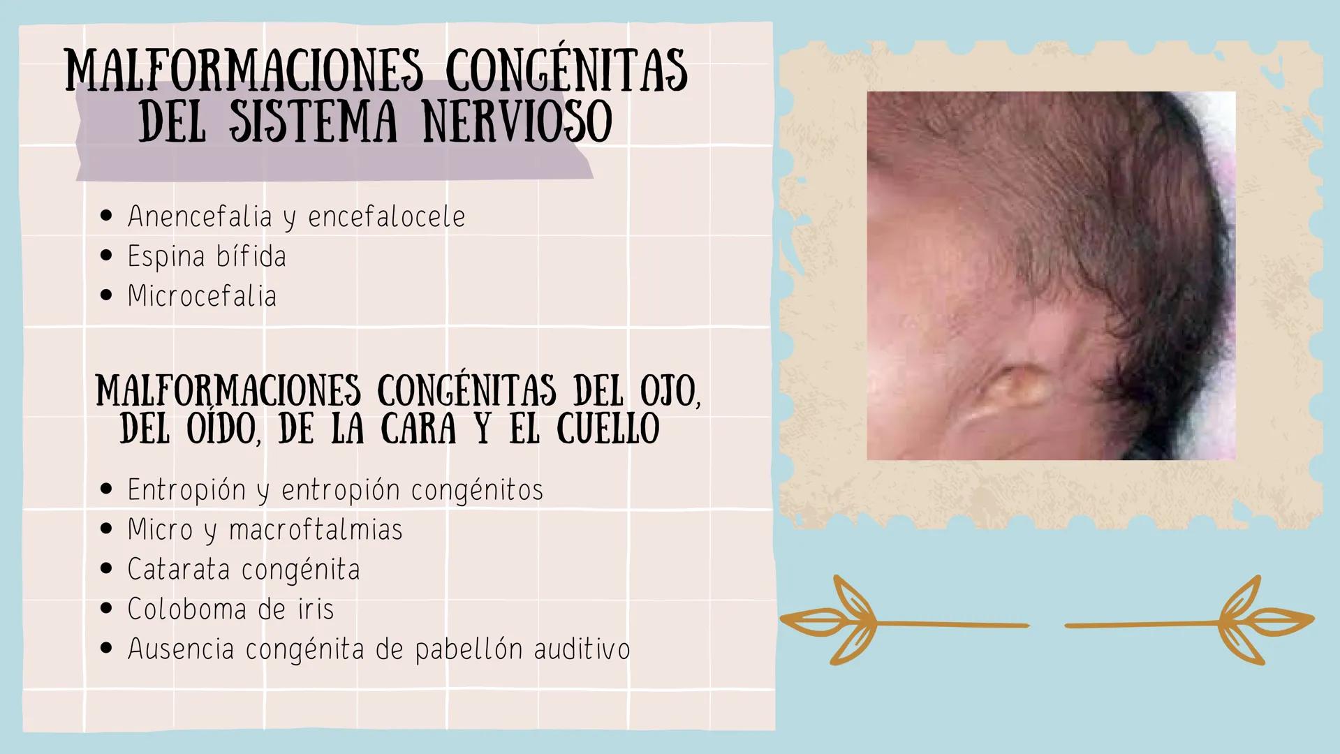 CUIDADOS DEL RECIÉN
NACIDO PREMATURO Y
RIESGO
Est. Lic. Enf.Daniela Alarcón de la Cruz
Est. Lic. Enf. Naomi Nava
Est. Lic. Enf. Catherine Co