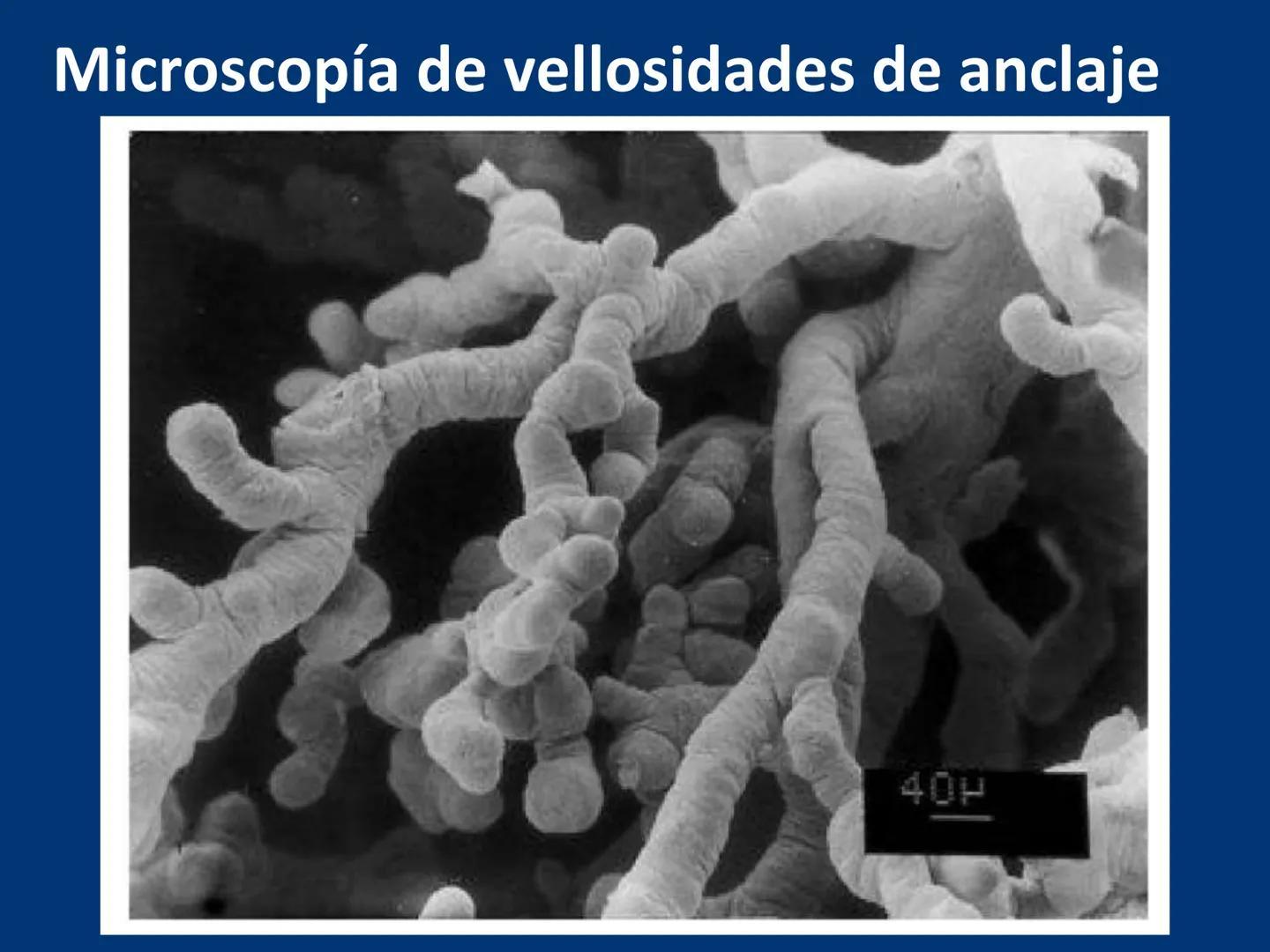 UNIVERSIDAD WESTHILL
VESTIGIA NULLA RETRORSUM
Embriología Humana I
Dr. Alejandro Farrera Hdz.
Desarrollo de
Placenta # Estructuras placent