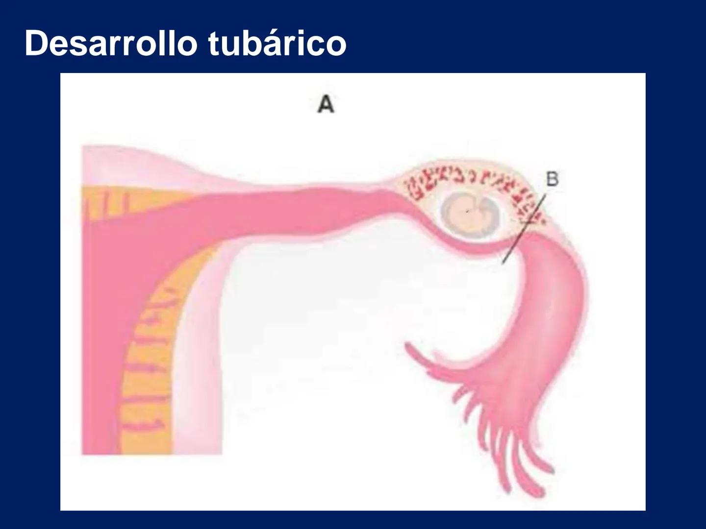 UNIVERSIDAD WESTHILL
VESTIGIA NULLA RETRORSUM
Embriología Humana I
Dr. Alejandro Farrera Hdz.
Desarrollo de
Placenta # Estructuras placent