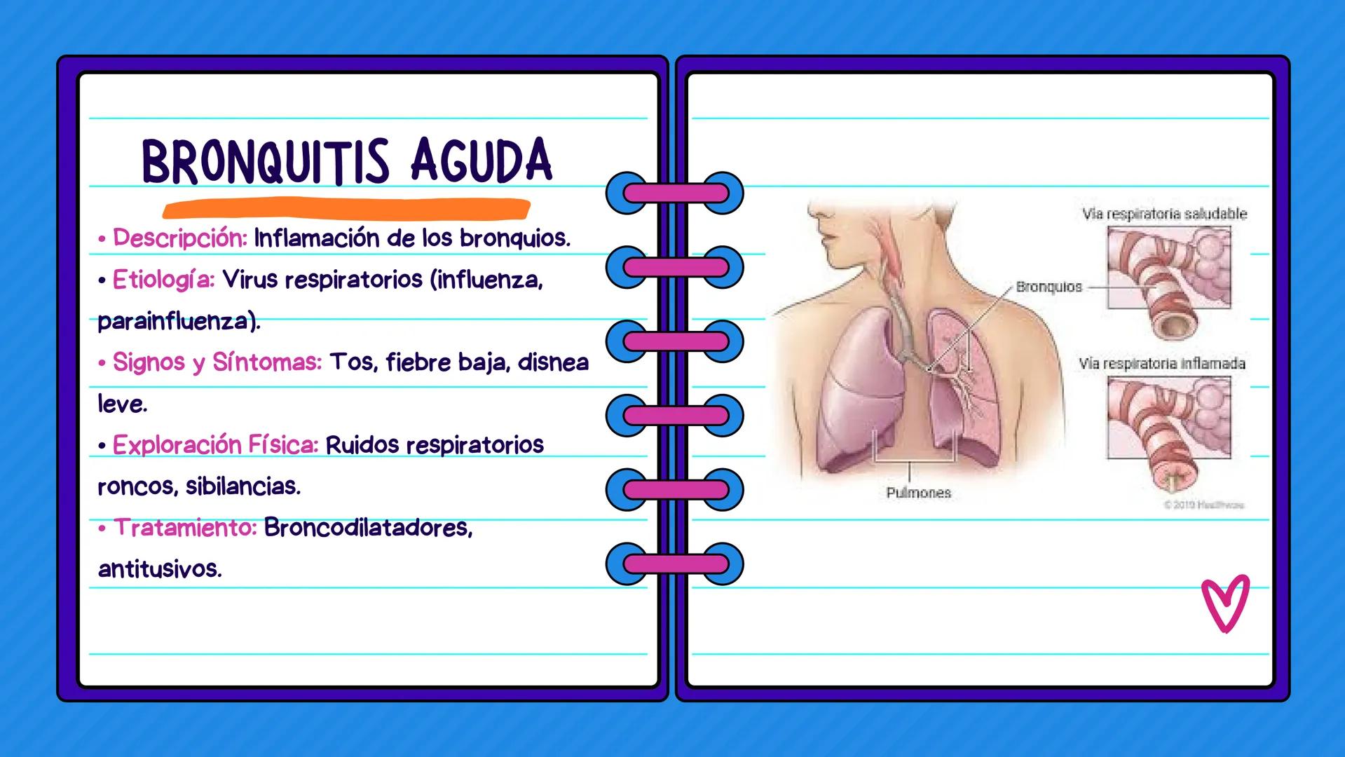 FLASH CARDS INFECCIÓNES DE
VÍAS AÉREAS # Infecciones de vías
aéreas superiores FARINGITIS AGUDA
• Descripción: Inflamación de la faringe.