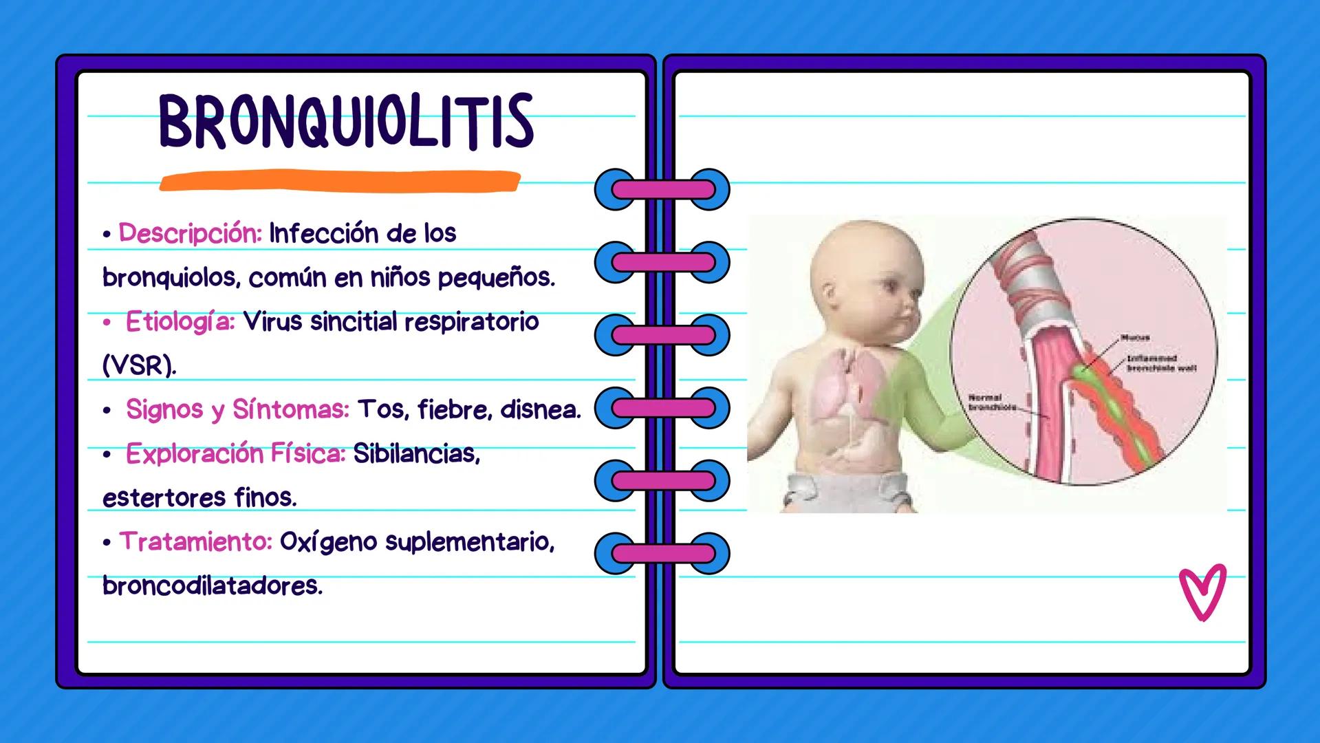 FLASH CARDS INFECCIÓNES DE
VÍAS AÉREAS # Infecciones de vías
aéreas superiores FARINGITIS AGUDA
• Descripción: Inflamación de la faringe.
