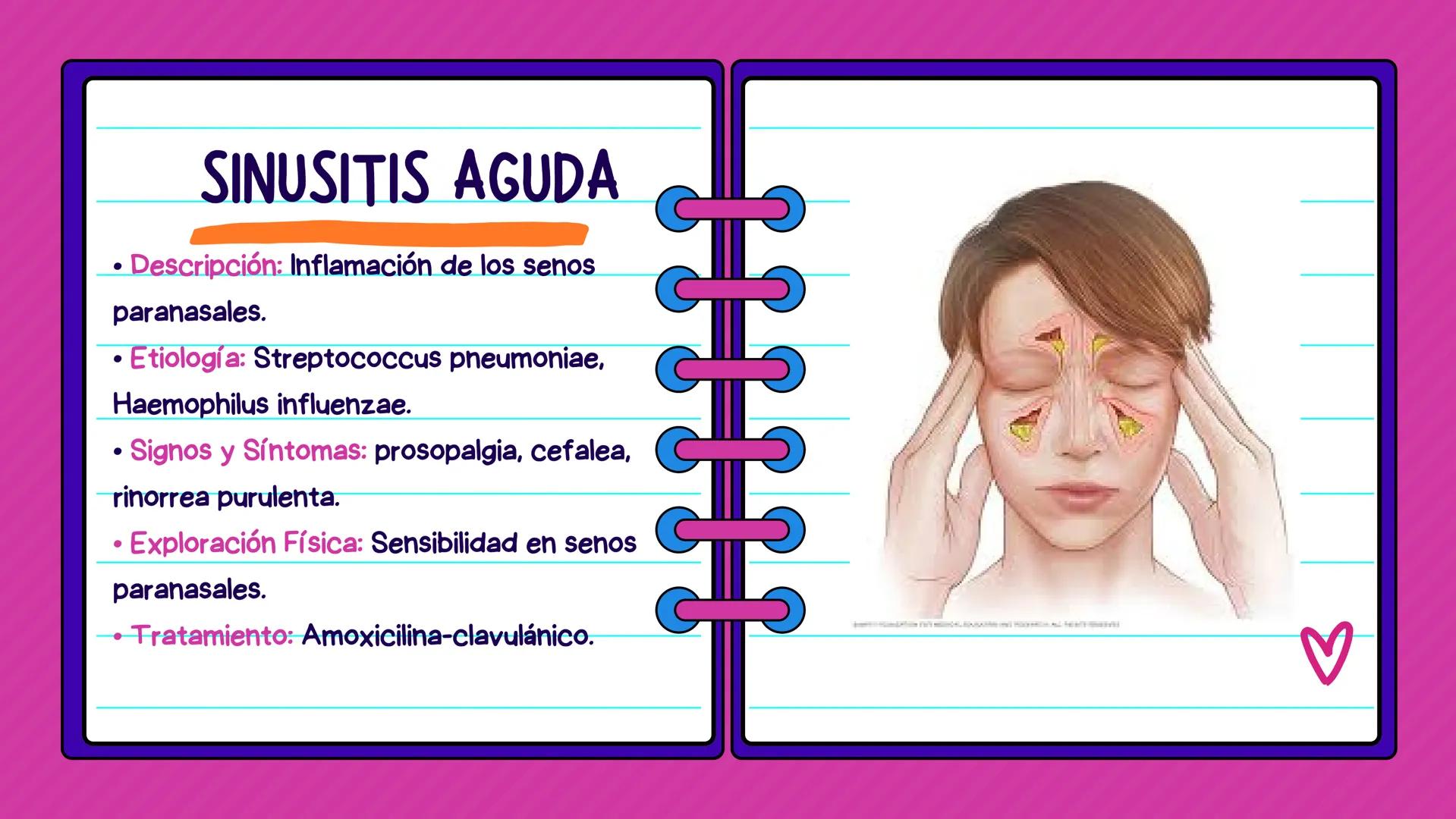 FLASH CARDS INFECCIÓNES DE
VÍAS AÉREAS # Infecciones de vías
aéreas superiores FARINGITIS AGUDA
• Descripción: Inflamación de la faringe.