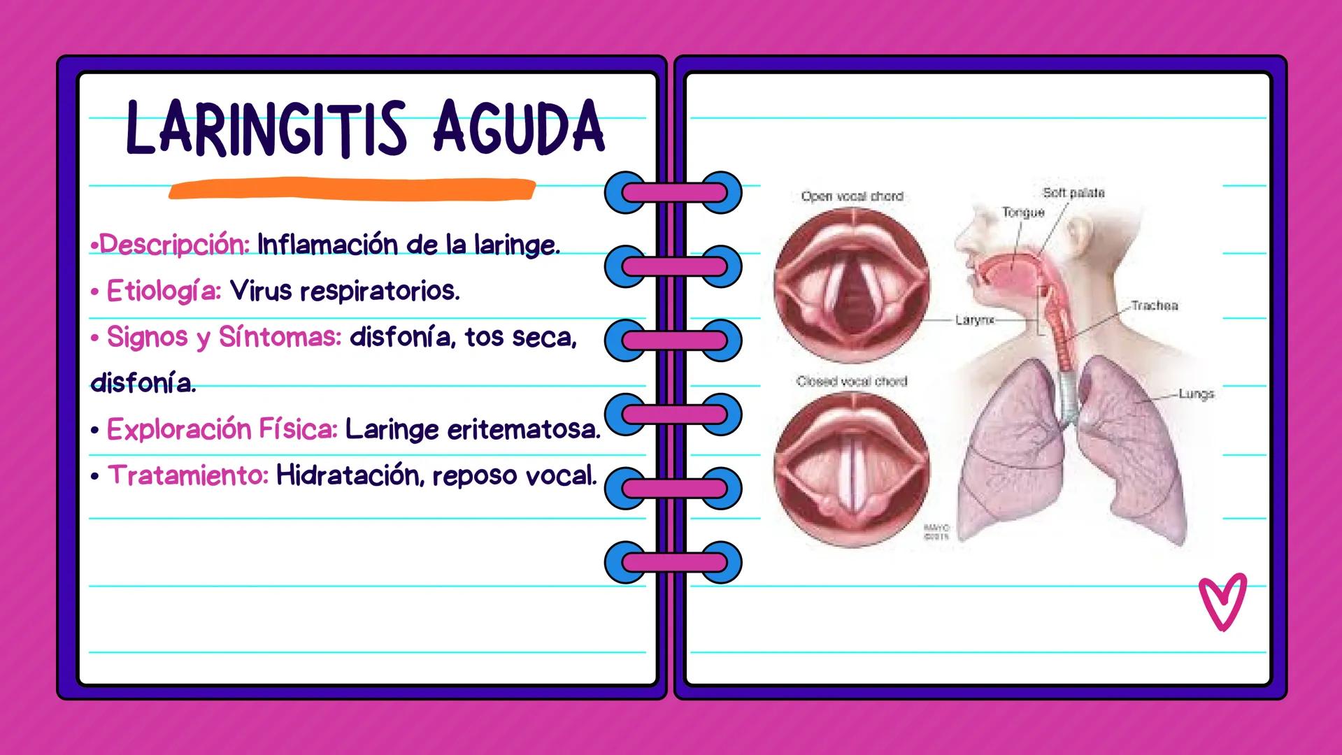 FLASH CARDS INFECCIÓNES DE
VÍAS AÉREAS # Infecciones de vías
aéreas superiores FARINGITIS AGUDA
• Descripción: Inflamación de la faringe.