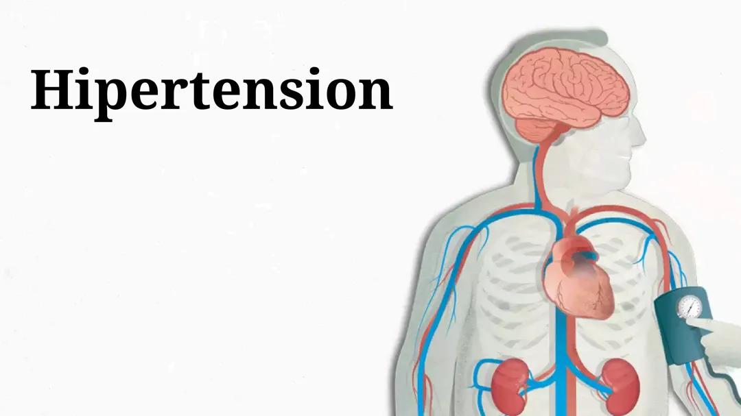 Hipertension