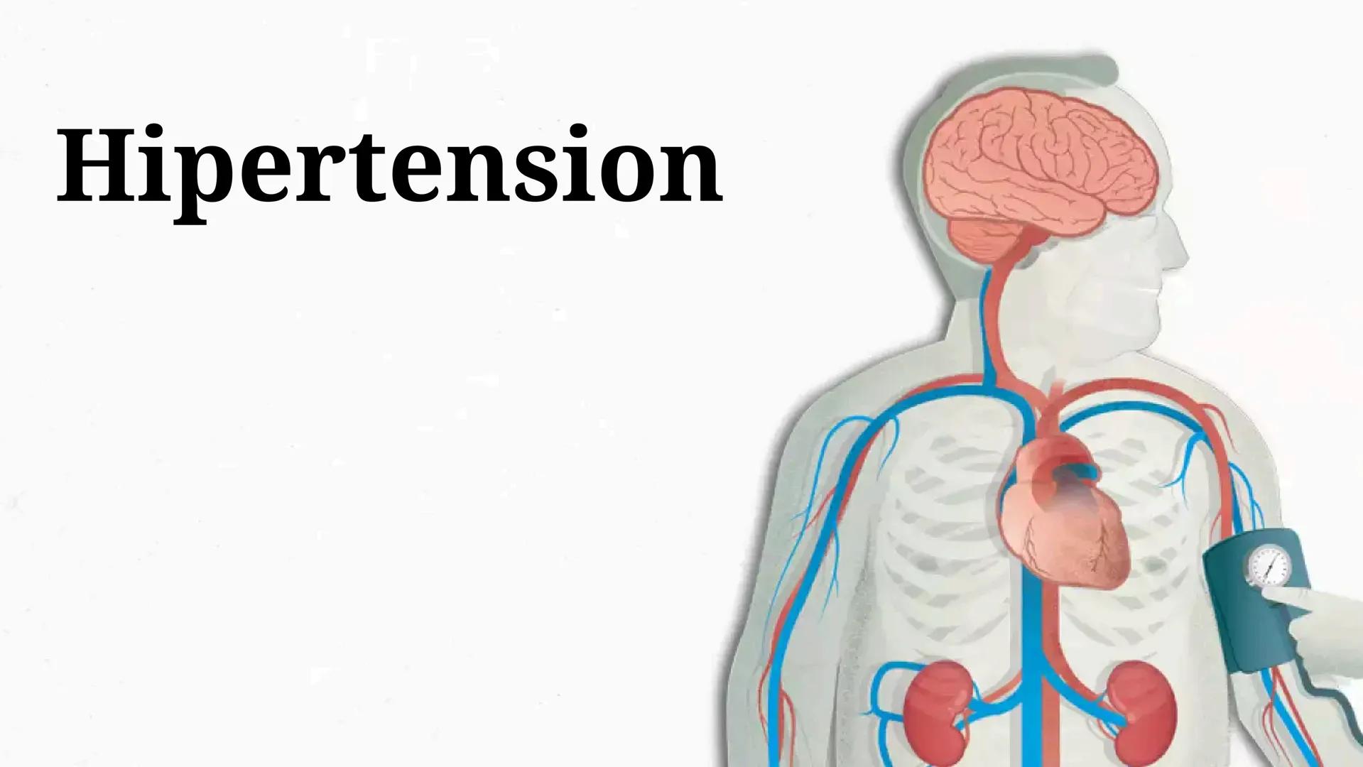 # Hipertension # Introduccion
La hipertensión arterial es, probablemente, la
enfermedad más prevalente que hay en el mundo y
afecta, aproxi