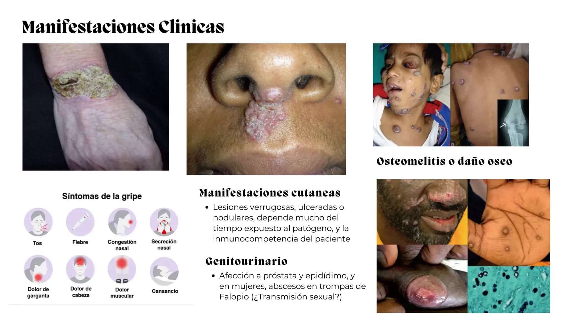 UNIVERSIDAD
POTOSINA
# Micosis Sistemáticas
Causadas por hongos dimórficos
Por Alejandro Cortez Y Julio
Meléndez Nava
Octubre 2024 # Hong