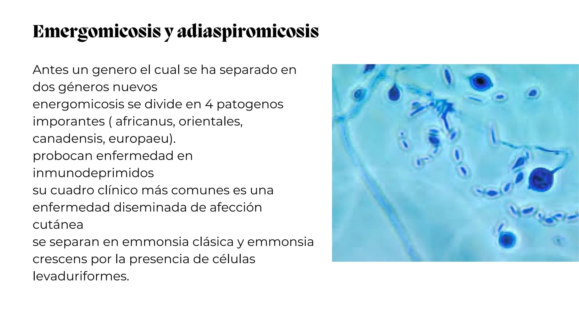 UNIVERSIDAD
POTOSINA
# Micosis Sistemáticas
Causadas por hongos dimórficos
Por Alejandro Cortez Y Julio
Meléndez Nava
Octubre 2024 # Hong