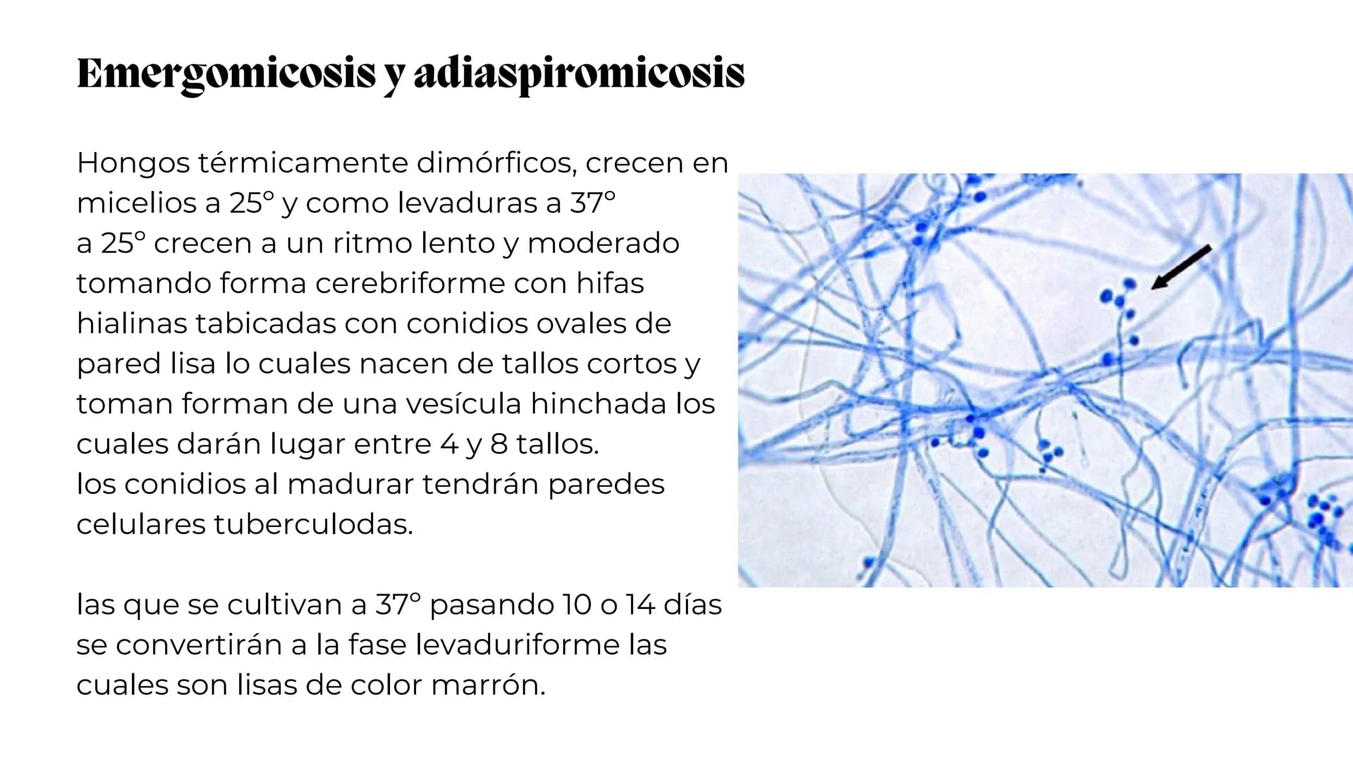 UNIVERSIDAD
POTOSINA
# Micosis Sistemáticas
Causadas por hongos dimórficos
Por Alejandro Cortez Y Julio
Meléndez Nava
Octubre 2024 # Hong