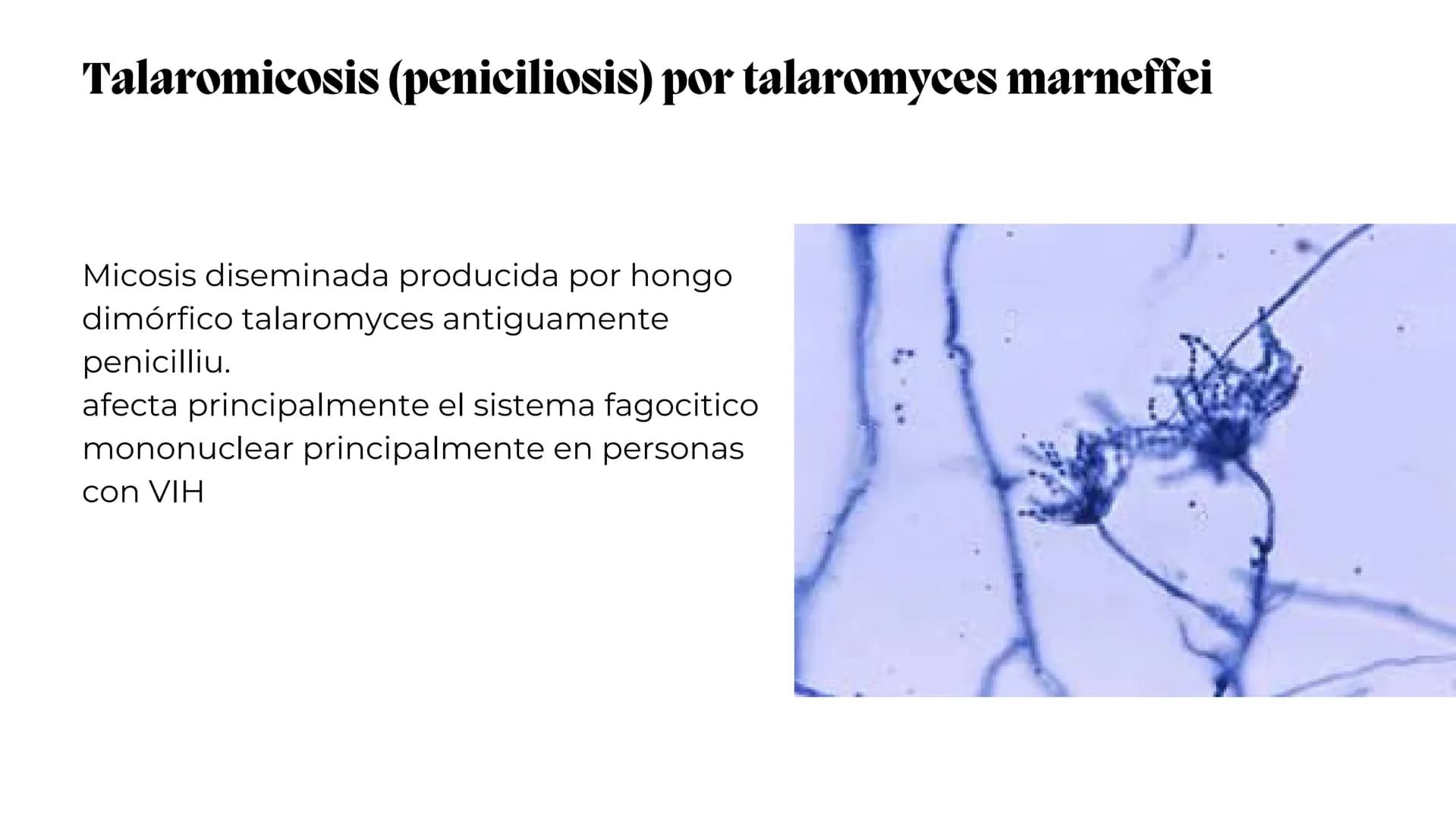 UNIVERSIDAD
POTOSINA
# Micosis Sistemáticas
Causadas por hongos dimórficos
Por Alejandro Cortez Y Julio
Meléndez Nava
Octubre 2024 # Hong