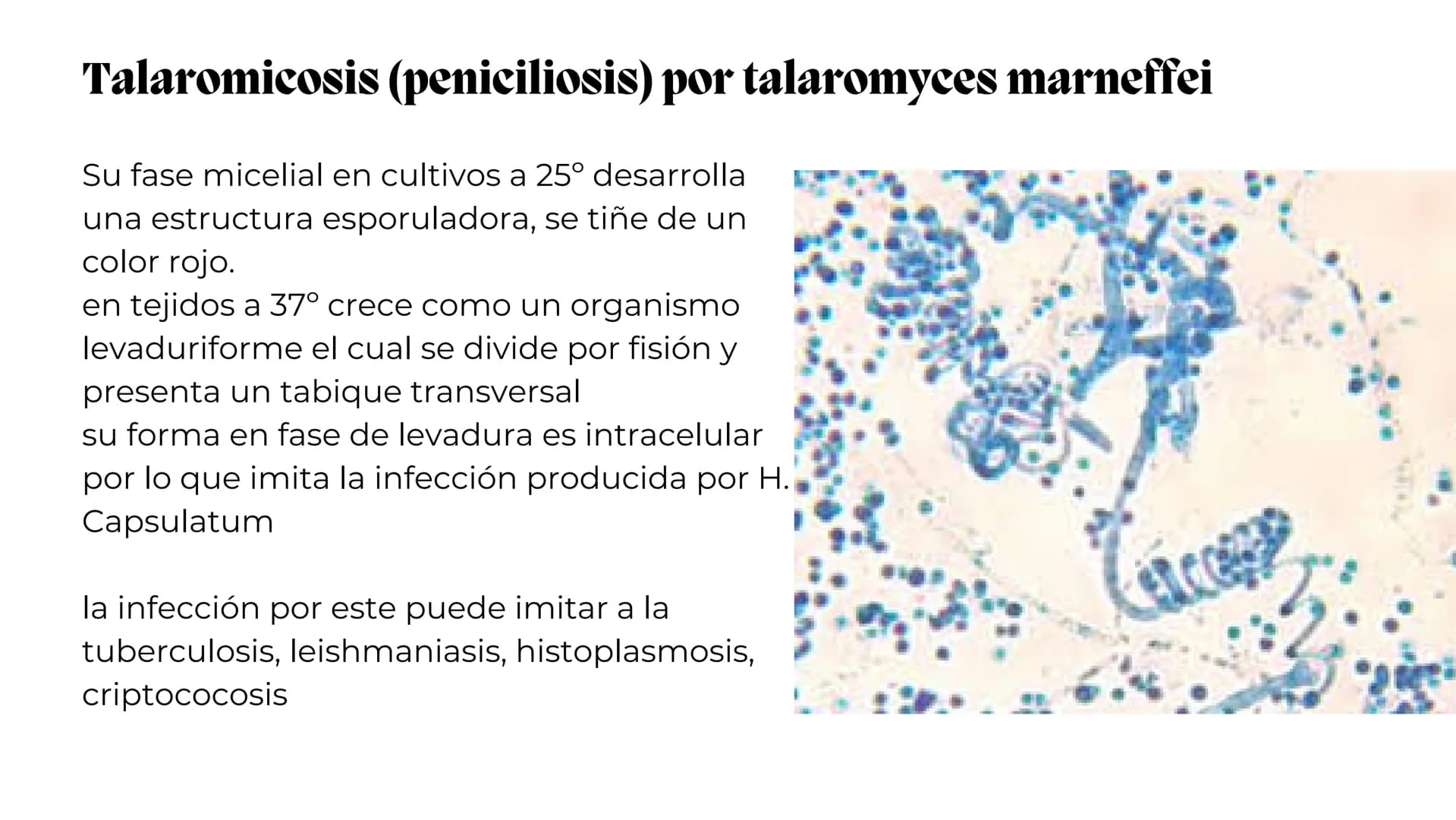 UNIVERSIDAD
POTOSINA
# Micosis Sistemáticas
Causadas por hongos dimórficos
Por Alejandro Cortez Y Julio
Meléndez Nava
Octubre 2024 # Hong