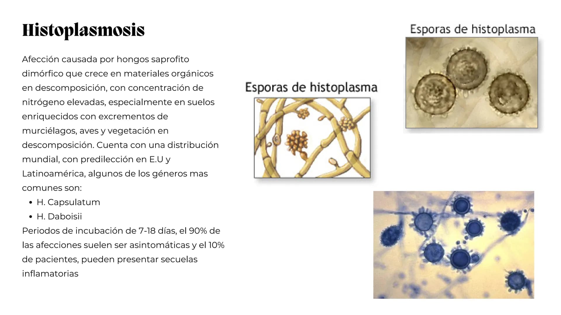 UNIVERSIDAD
POTOSINA
# Micosis Sistemáticas
Causadas por hongos dimórficos
Por Alejandro Cortez Y Julio
Meléndez Nava
Octubre 2024 # Hong
