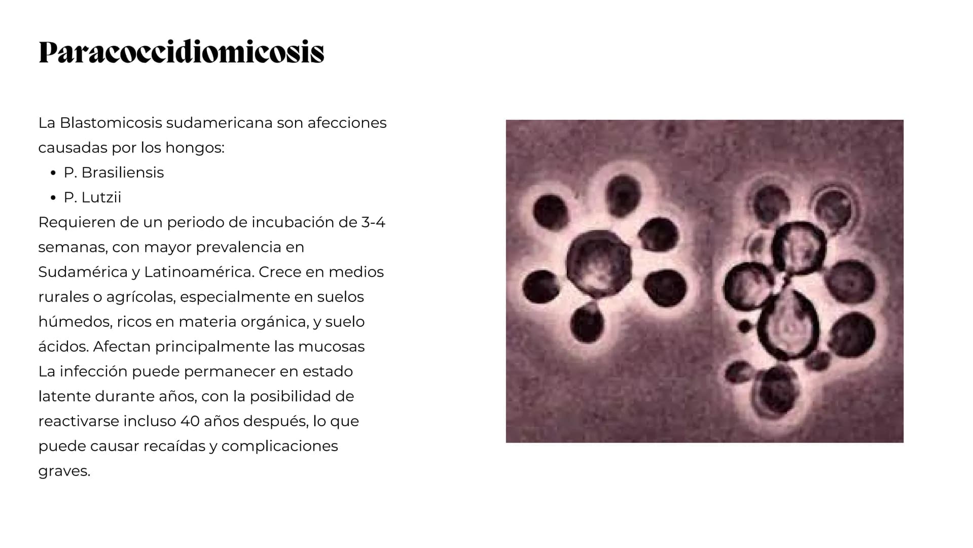 UNIVERSIDAD
POTOSINA
# Micosis Sistemáticas
Causadas por hongos dimórficos
Por Alejandro Cortez Y Julio
Meléndez Nava
Octubre 2024 # Hong