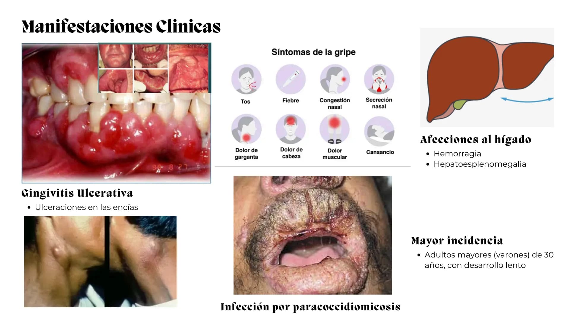 UNIVERSIDAD
POTOSINA
# Micosis Sistemáticas
Causadas por hongos dimórficos
Por Alejandro Cortez Y Julio
Meléndez Nava
Octubre 2024 # Hong