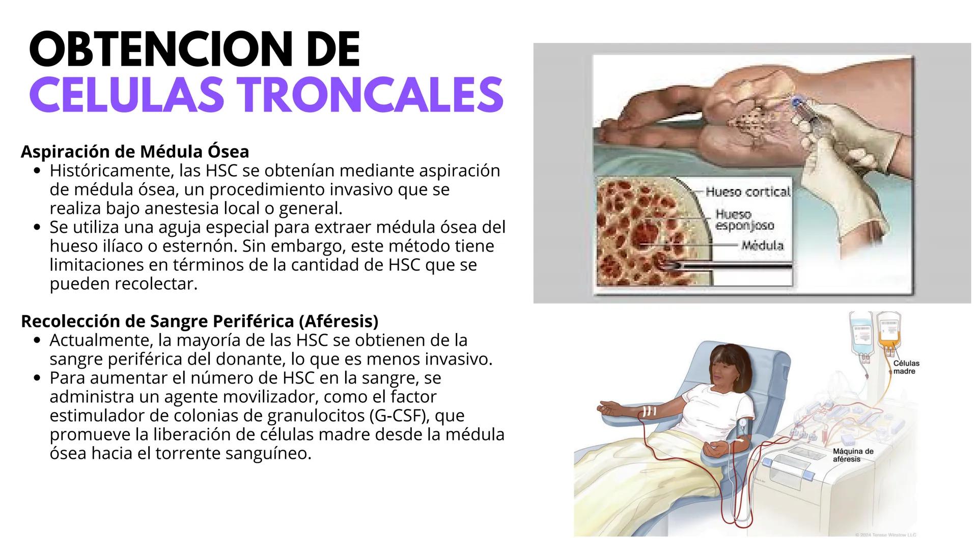# UNIVERSIDAD
POTOSINA
Alejandro Cortez Grimaldo
# TRANSFUSION
# SANGUINEA
Sistema A B O y Rh # TRANSFUSION
SANGUINEA
* Procedimiento