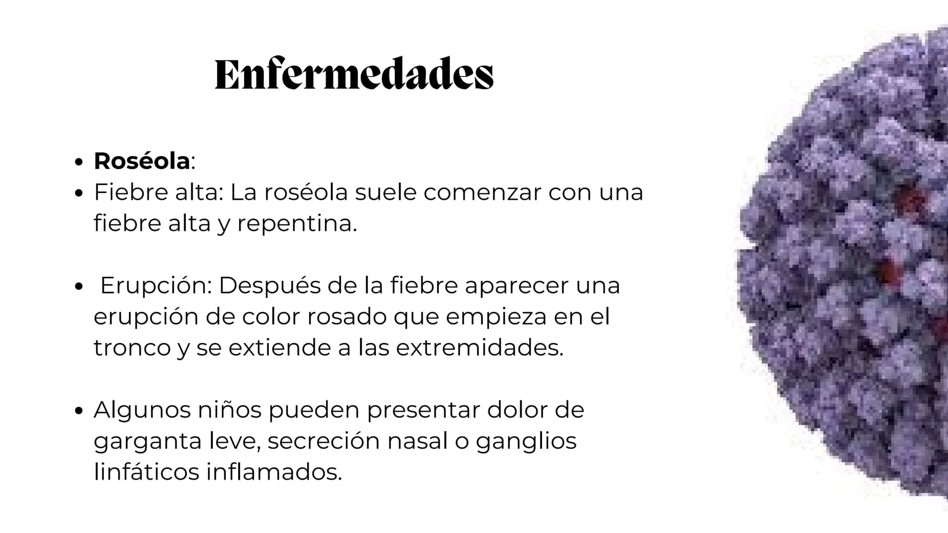 UNIVERSIDAD
POTOSINA
# Virus del herpes
Patogenia, transmision y manifestaciones
clínicas del herpes
Por Alejandro Cortez y
Julio Melénde