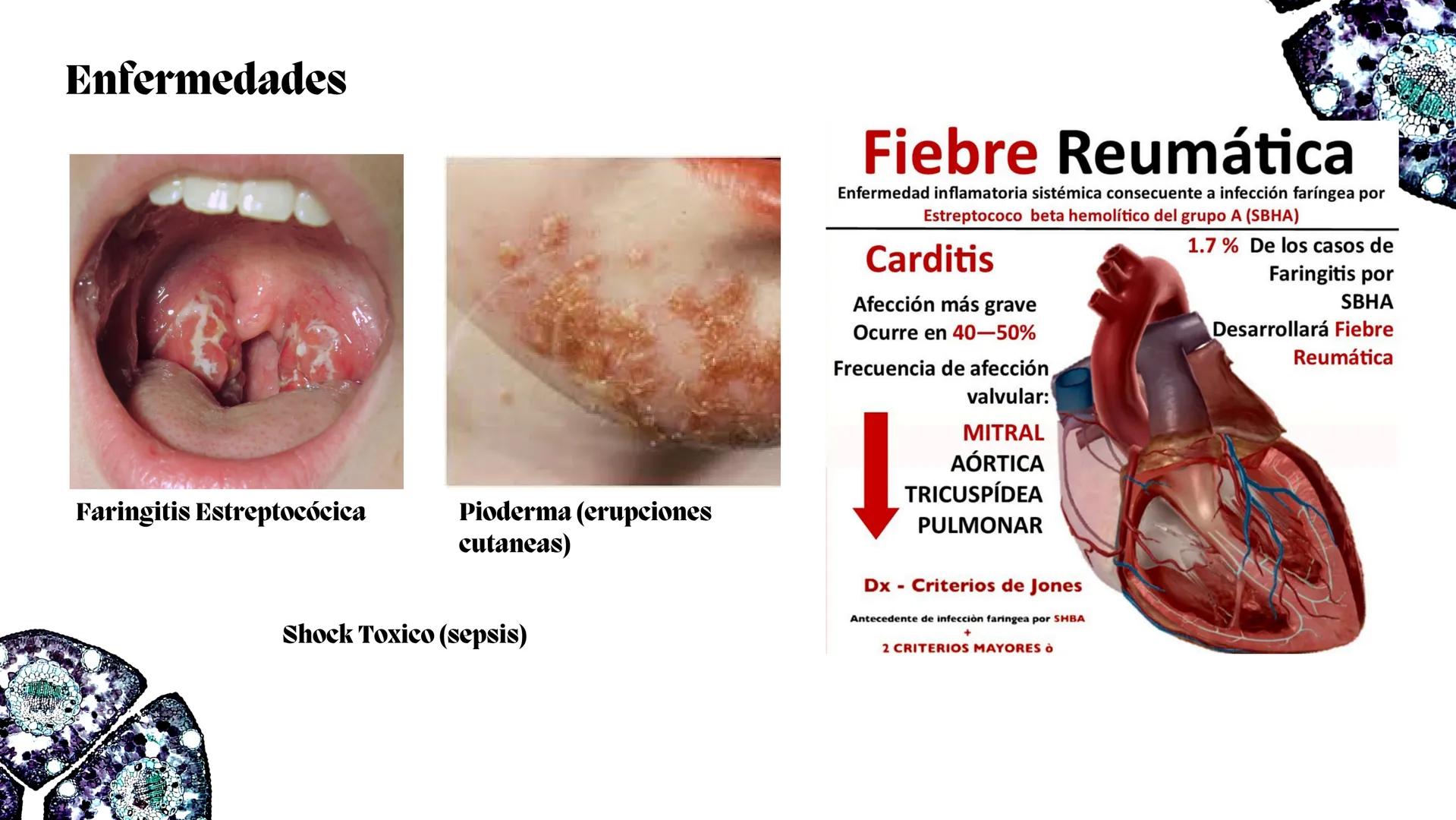 # Estreptococos
Microorganismos clínicamente
significativos
Alejandro Cortez Grimaldo
Julio Meléndez Nava
Agosto 2024 # Introducción
*