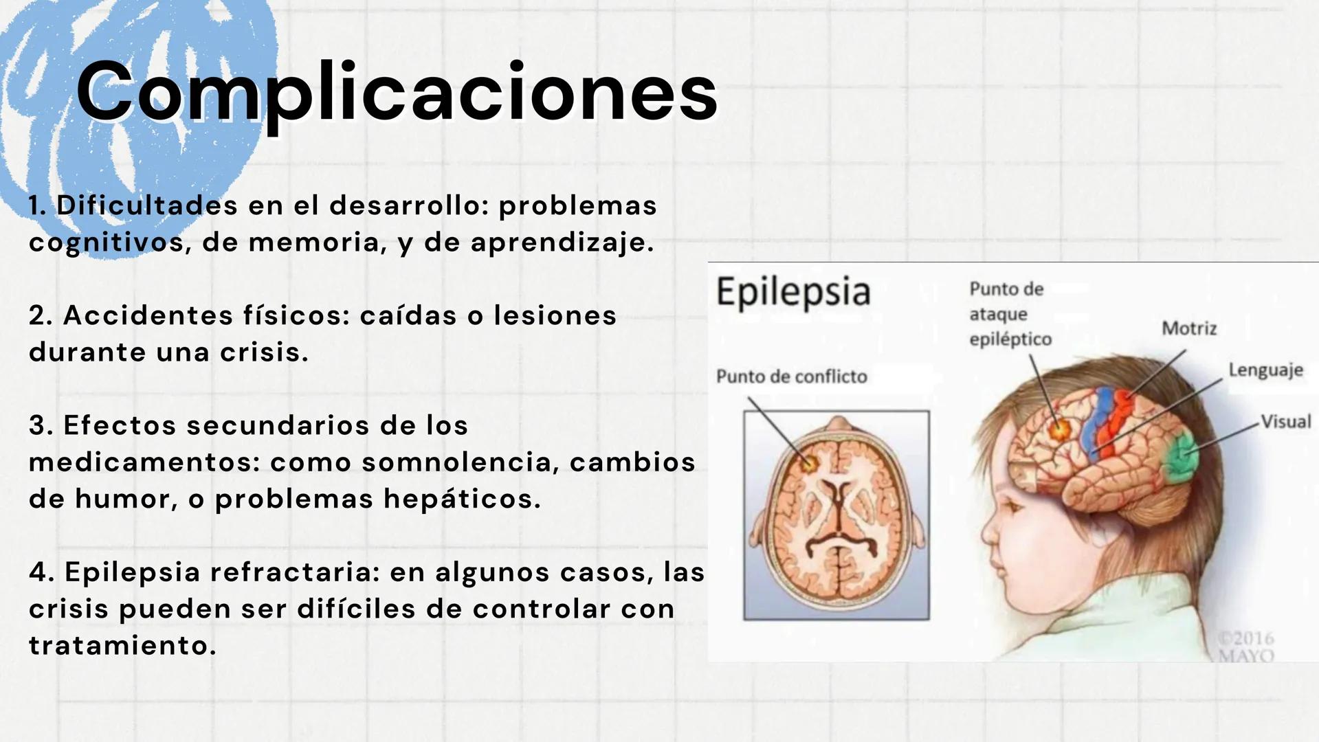 # Epilepsia
Nancy Jocabeth Flores Rosas # Definición
La epilepsia es un trastorno
neurológico caracterizado por la
aparición de crisis epi