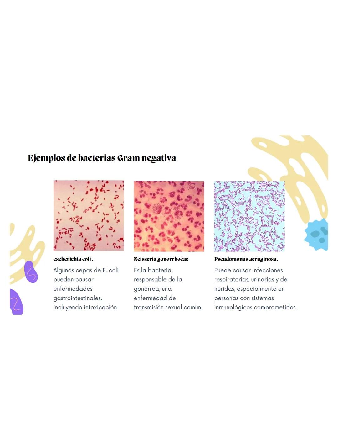 EQUIPO 2
Anatomia bacteriana mmm
Contenidos.
1. Anatomía Bacteriana y de hongos
2. Clasificación por pared celular
3. Tinción de Gram.
4.