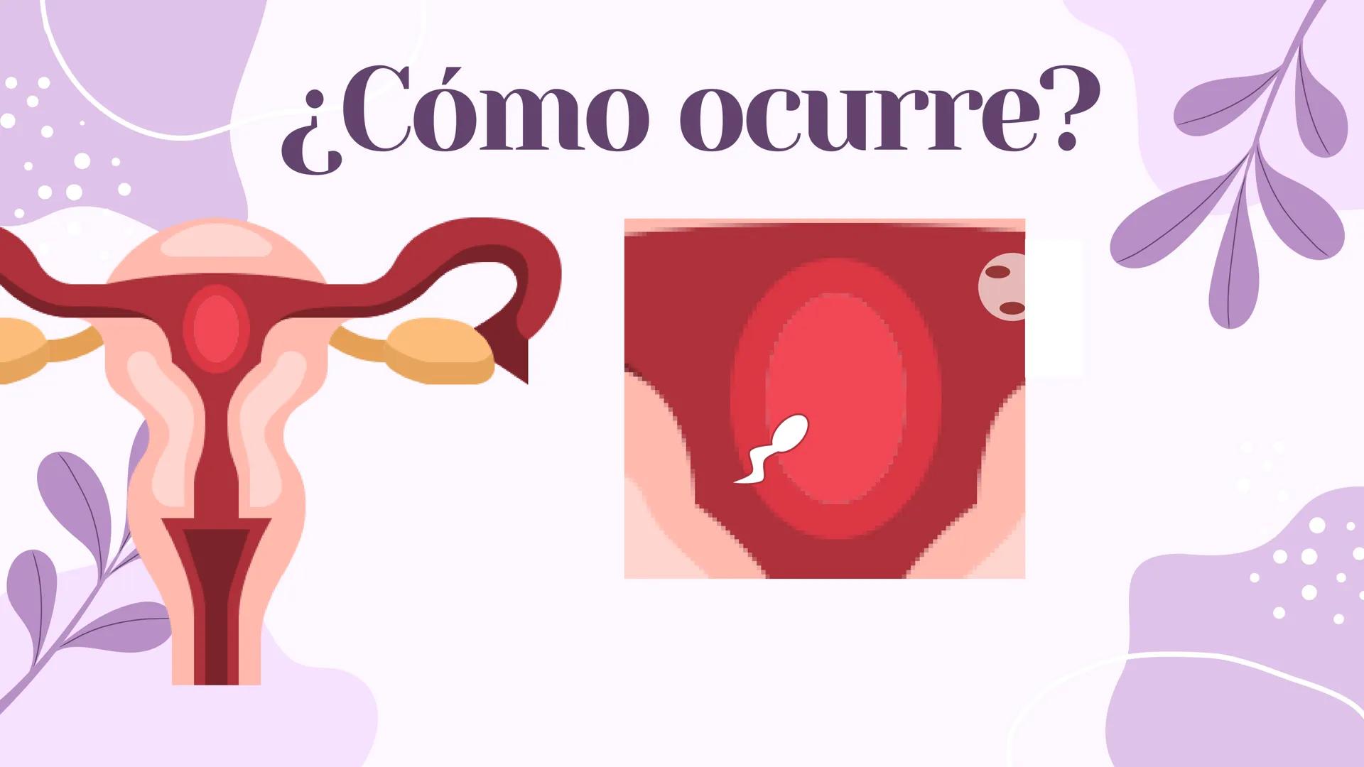 EMBARAZO
ECTOPICO # 1
# Concepto
El embarazo ectopico se pede comprender como el embarazo
fuera del endometrio, es decir, en las trompas u
