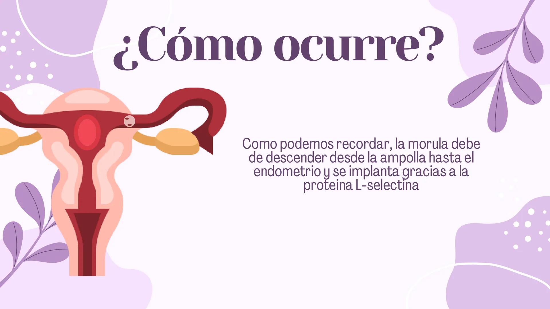 EMBARAZO
ECTOPICO # 1
# Concepto
El embarazo ectopico se pede comprender como el embarazo
fuera del endometrio, es decir, en las trompas u