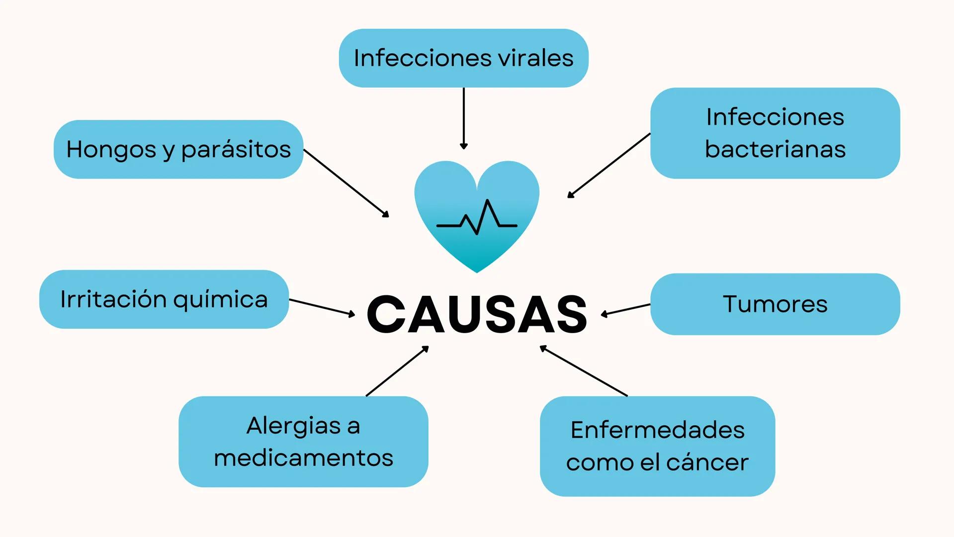 +
JJ *
M
MENINGITIS
+ ¿QUÉ ES?
La meningitis es la inflamación
de los tejidos que rodean el
cerebro y la médula espinal.
Suele deberse a una