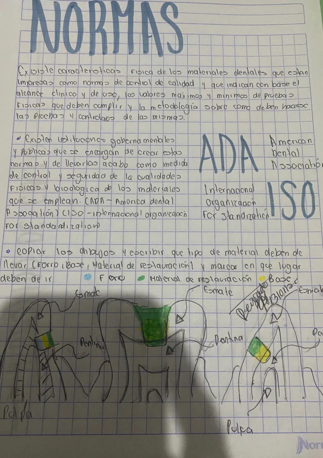 # RESTAURACION
dentabes
• In algunos de las caso se deben hacer uso de bo materiako
melalicos, ceramicos, plasticos yses combinanciones, co