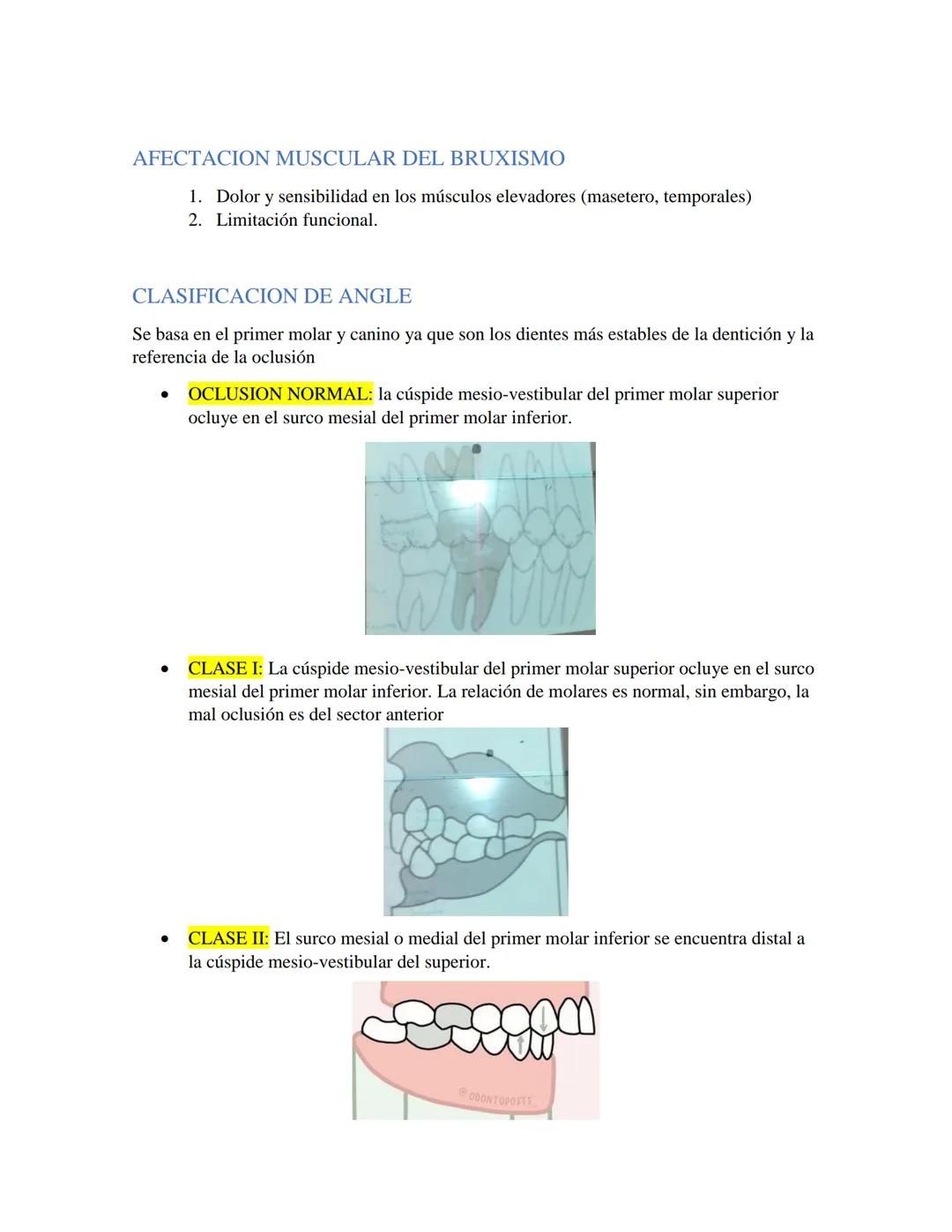 # GUIA DE OCLUSION
- OCLUSION: Es la relación anatómica funcional multifactorial entre los dientes con
los otros componentes, elementos del