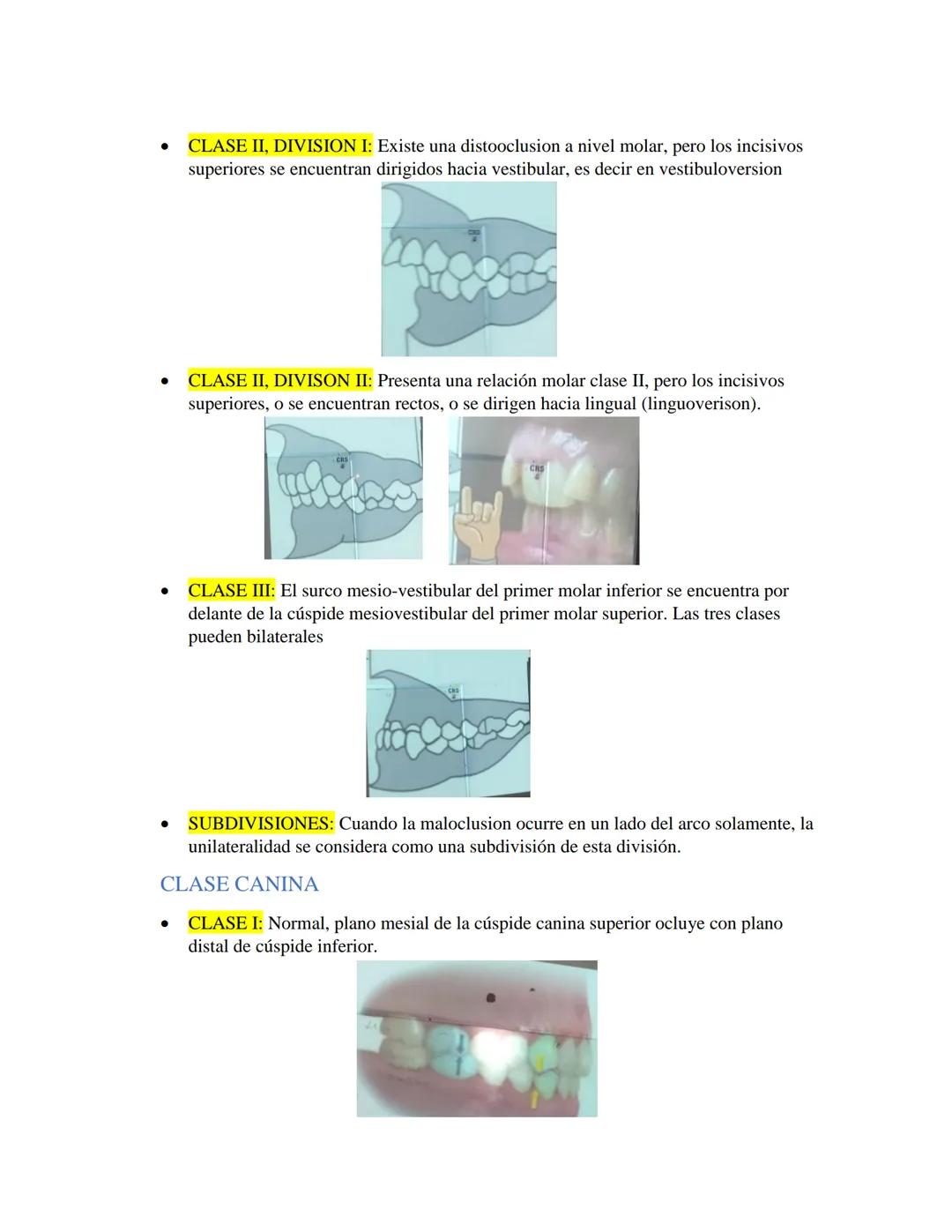 # GUIA DE OCLUSION
- OCLUSION: Es la relación anatómica funcional multifactorial entre los dientes con
los otros componentes, elementos del