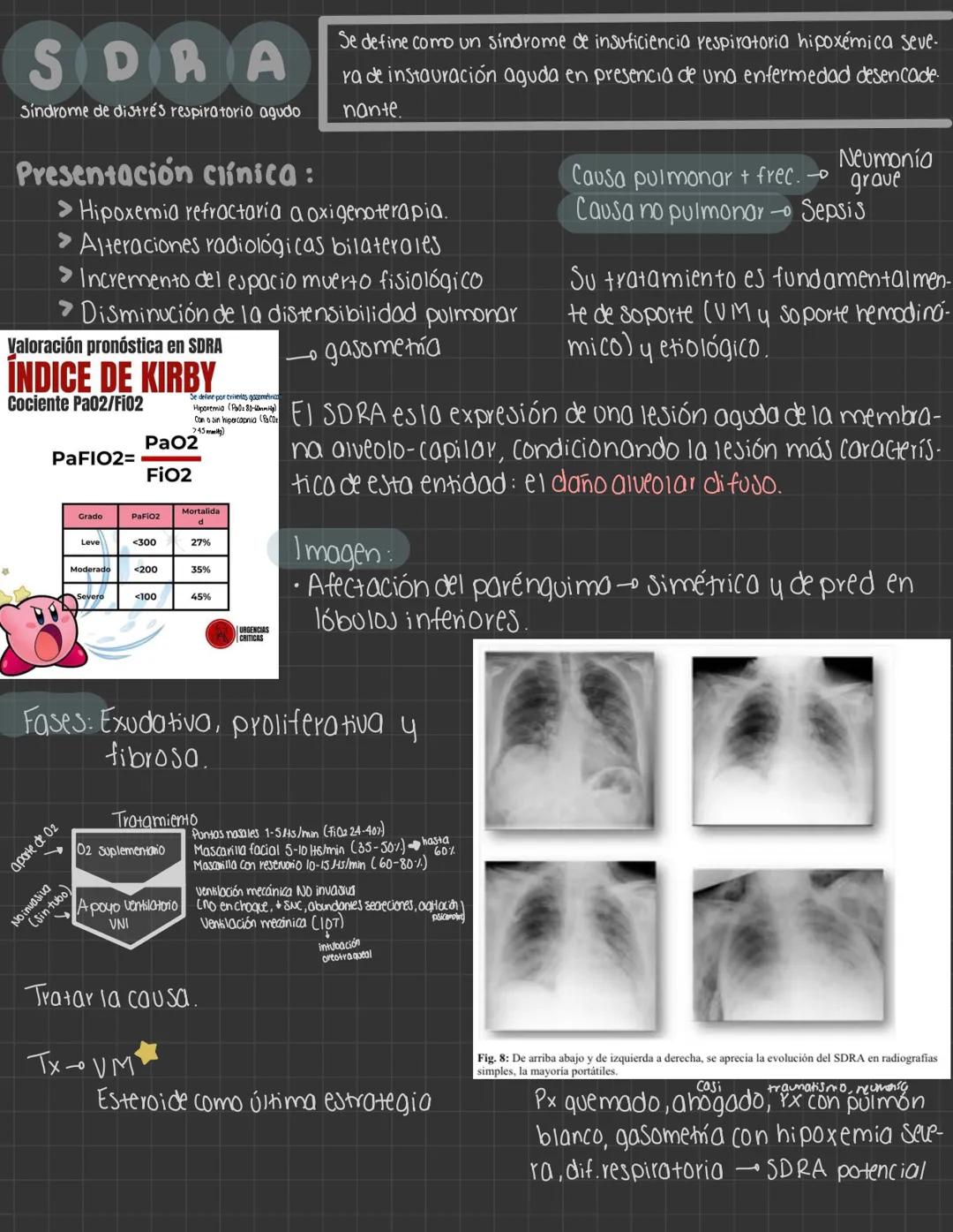 Entregar expos 48hrs antes
Temas del 1° Parcial
* Arotomía y fisiologio
* Semiología respiratoria
* Sx pleuropulmonares
* Bronquiti