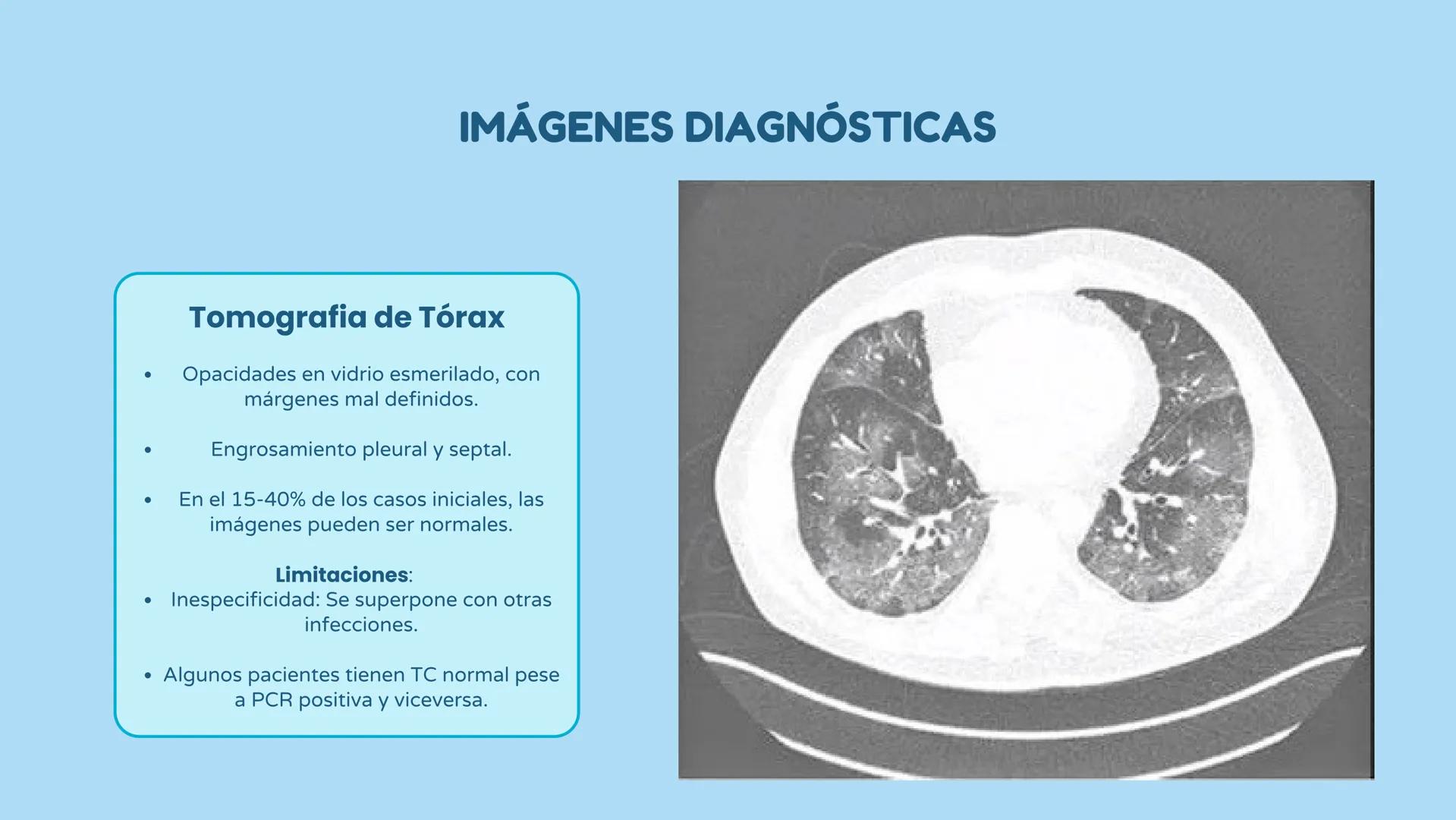 UATX
UNIVERSIDAD AUTÓNOMA DE TLAXCALA
COVID-19
- Sandra Isamar Pérez Zárate
- Diana Laura George Muñoz
- Valeria Martínez Pérez
- Ana Belén