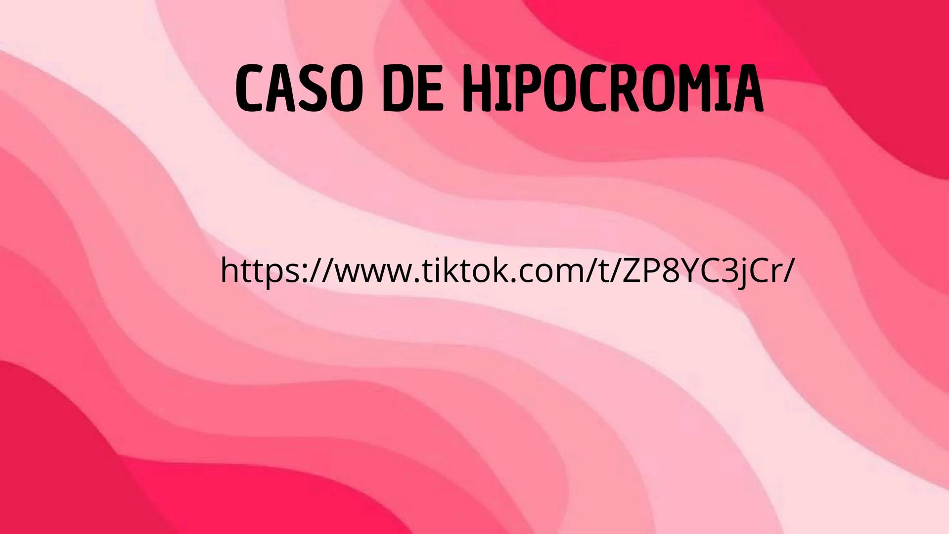 # HEMATOPOYESIS
EQUIPO #3 # Chelssy Janeth Cisneros Rodriguez
¿Qué es la
Hematopoyesis? Chelssy Janeth Cisneros Rodriguez
¿Qué es la Hema