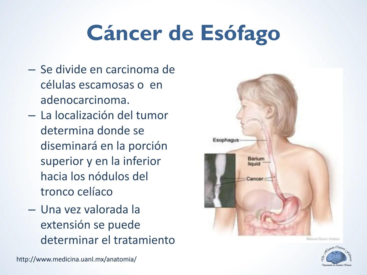 De Humani Corporis Fabri
Departamento de Anatomía Humana
TÓRAX
Mediastino Superior, Posterior y
http://www.medicina.uanl.mx/anatomia/
A