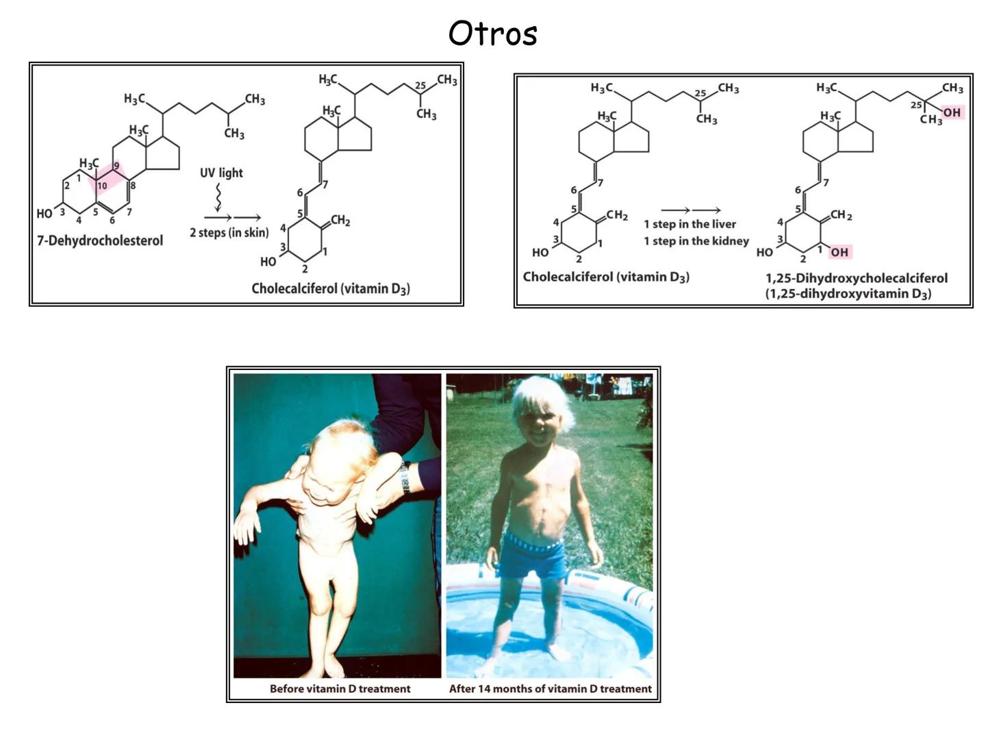 # Fundamentos de Bioquímica
Lípidos
FLUID
Phosphatidyl
Choline Bilayer
Carbon/Palmitic
Nitrogen Oleic
Oxygen
Water Oxygens
Phosphorus
H