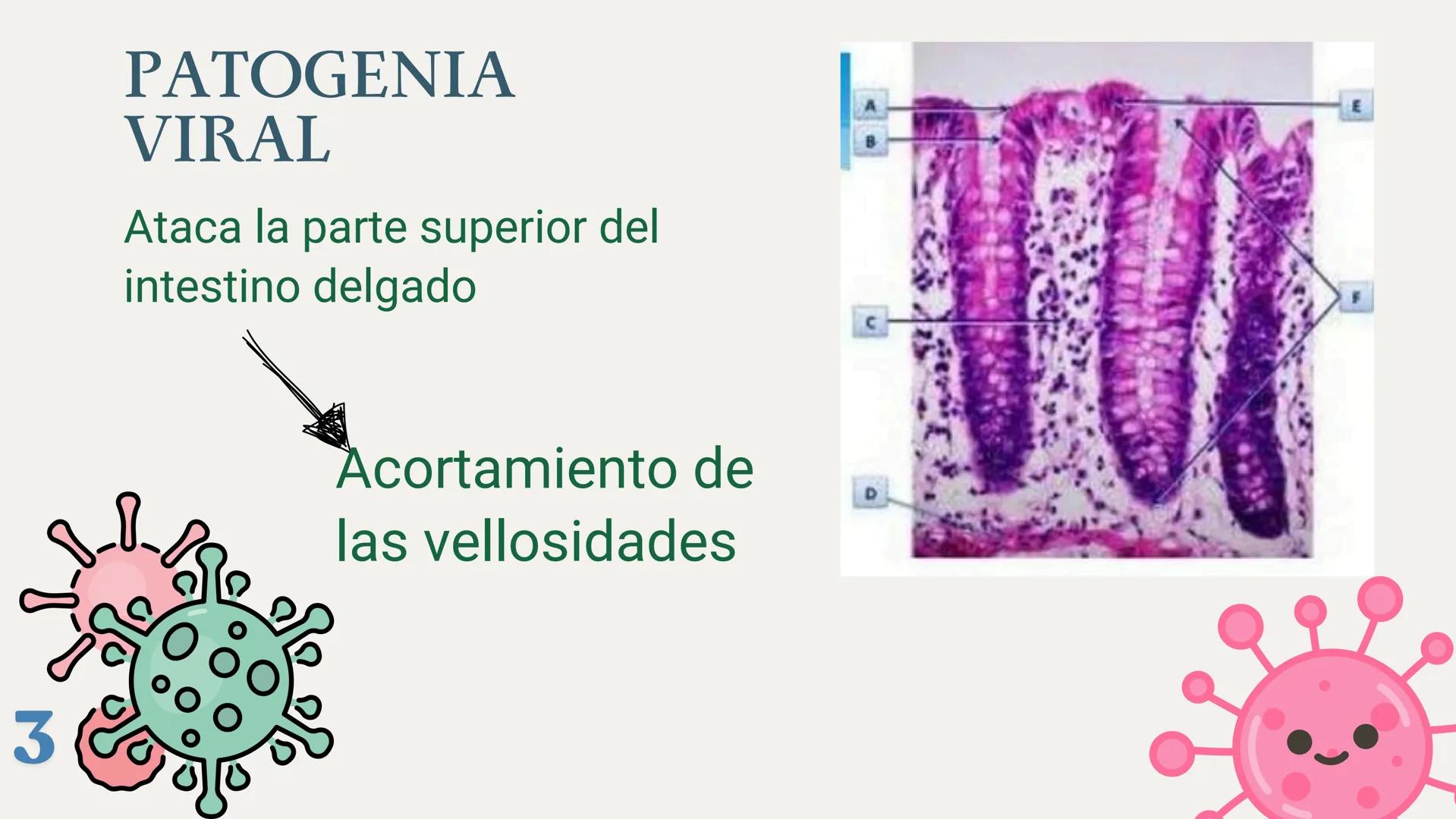 UBBJ
DIARREAS
INFECCIOSAS
Por Virus y Bacterias 1
# DEFINICIÓN
Según la OMS como la eliminación de heces
líquidas o semiliquidas en un nú