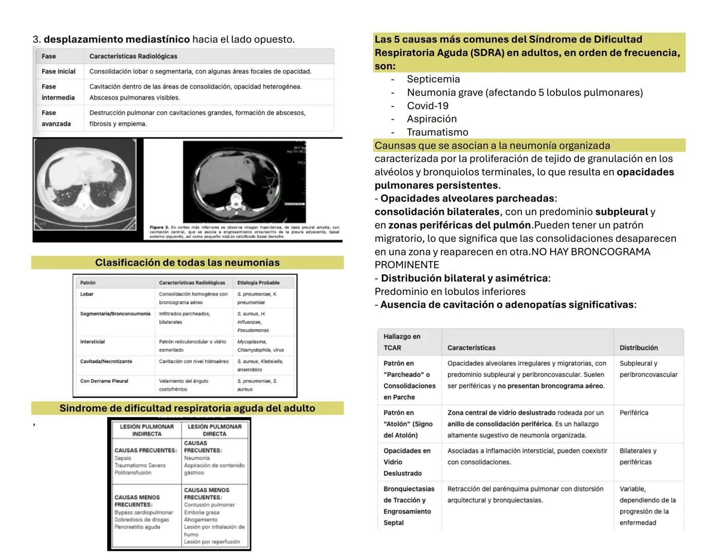 NEUMONIA 1 OBJETIVOS
Pectus excavatum
genera una concavidad en la parte anterior del tórax. (Torax en
embudo hace referencia la forma que ge