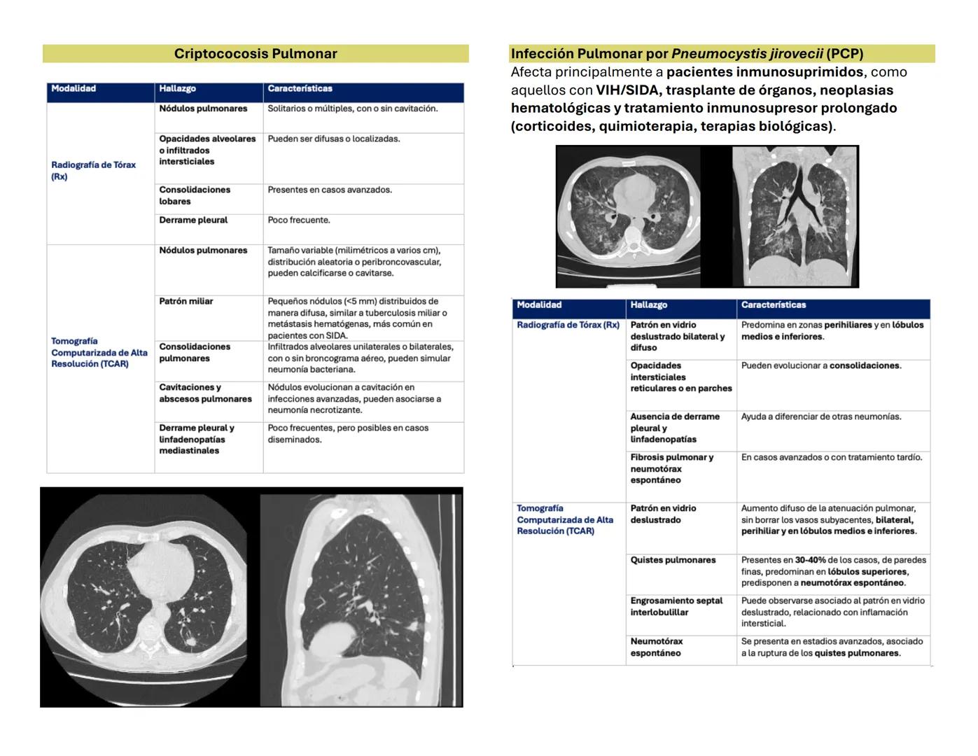 NEUMONIA 1 OBJETIVOS
Pectus excavatum
genera una concavidad en la parte anterior del tórax. (Torax en
embudo hace referencia la forma que ge